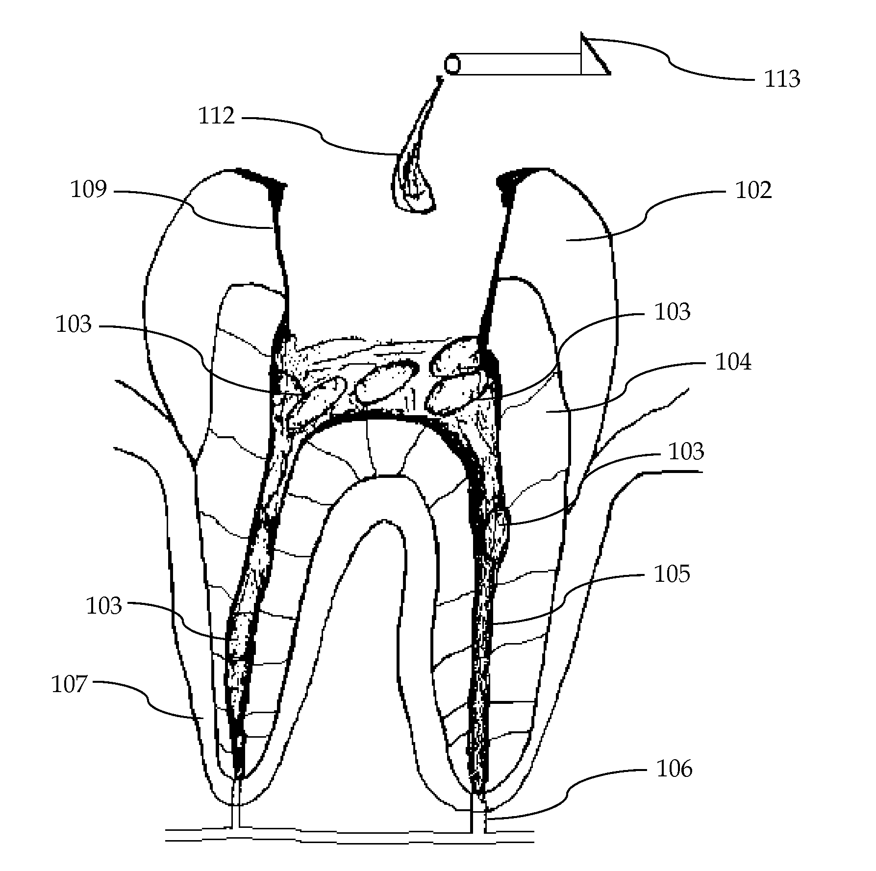Composition and method of using medicament for endodontic irrigation, stem cell preparations and tissue regeneration