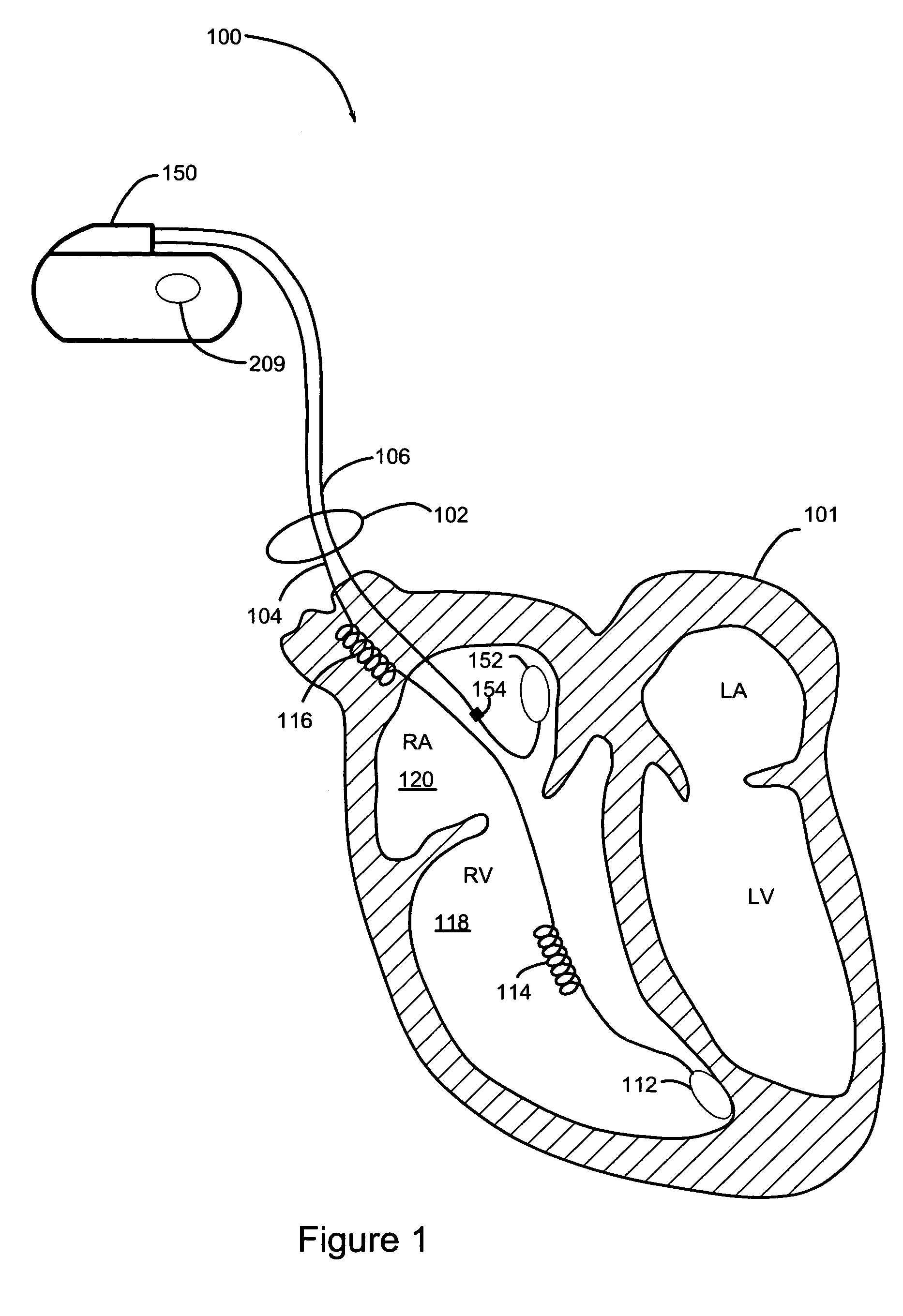 System and method for selection of morphology templates