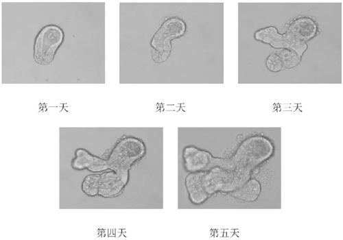 Detection method for evaluating intestine toxicity of medicine by utilizing 3D organ