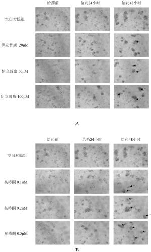 Detection method for evaluating intestine toxicity of medicine by utilizing 3D organ