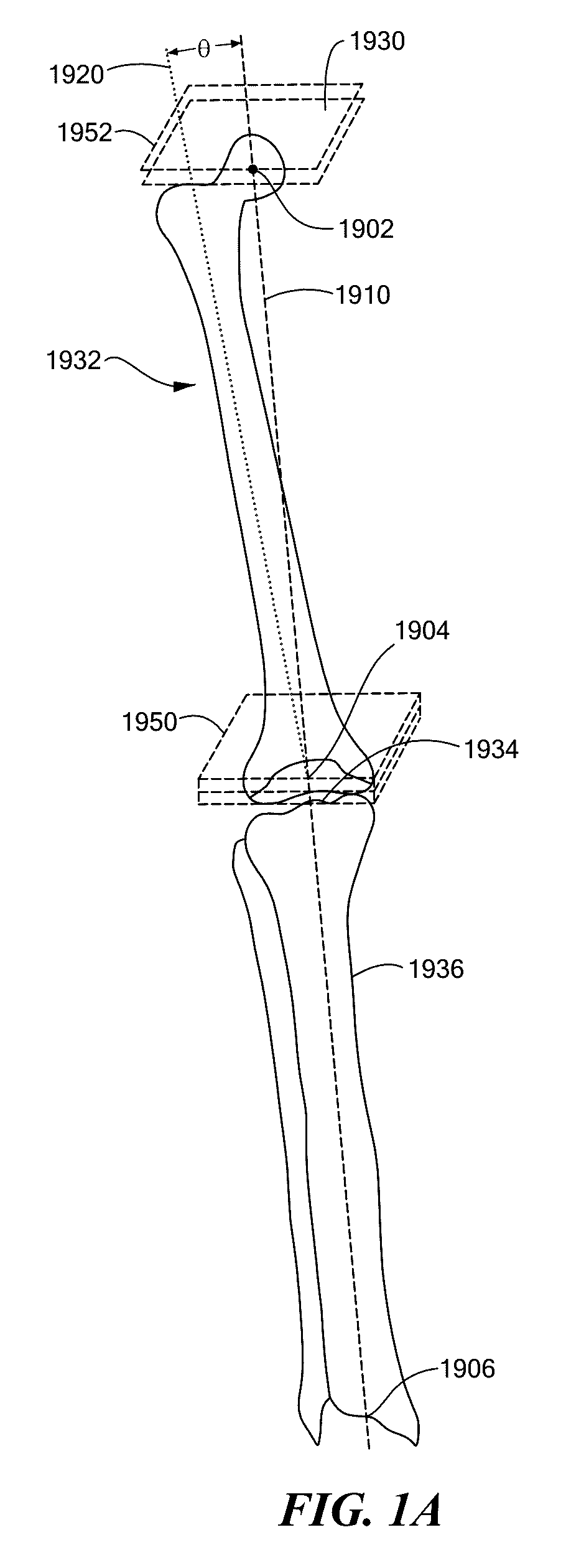 Patient Selectable Joint Arthroplasty Devices and Surgical Tools