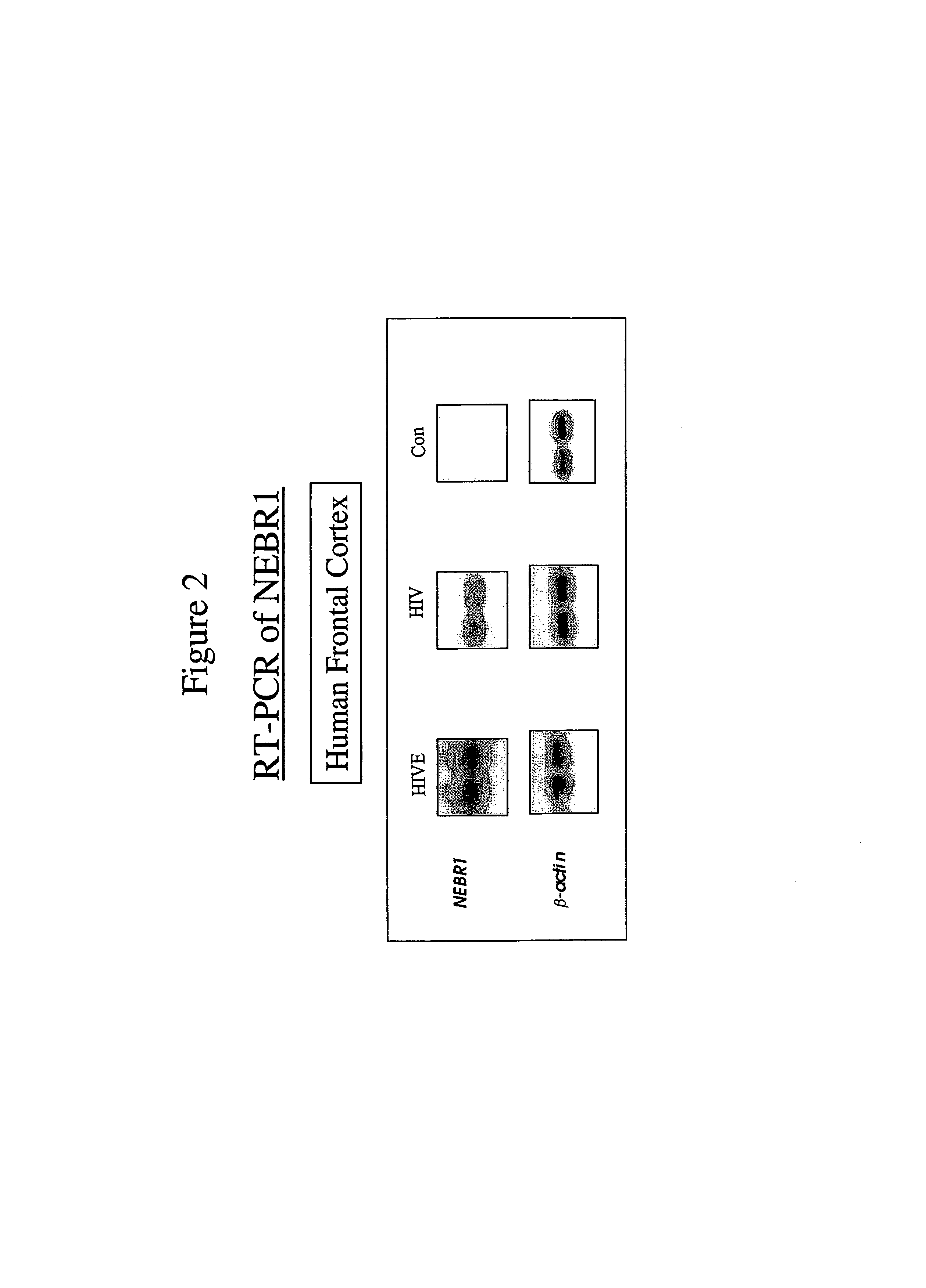 Antibodies specific for NEBR1 and methods of use thereof