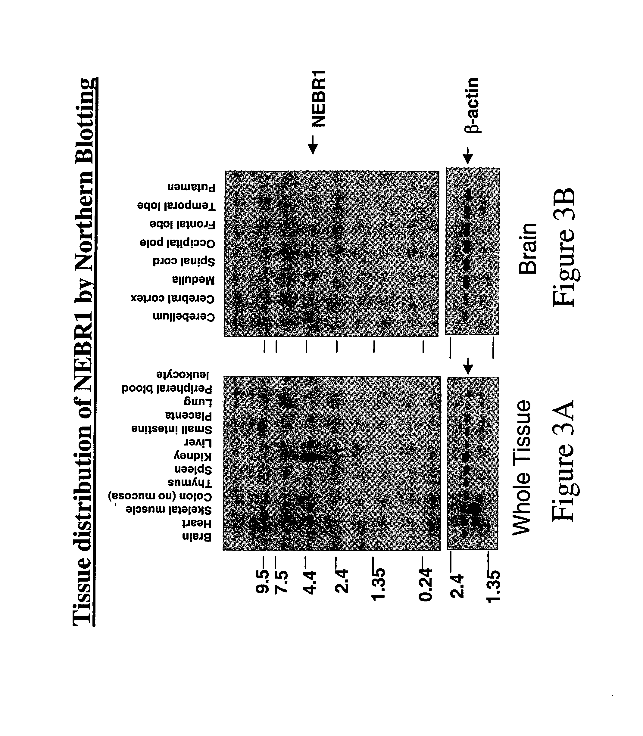 Antibodies specific for NEBR1 and methods of use thereof