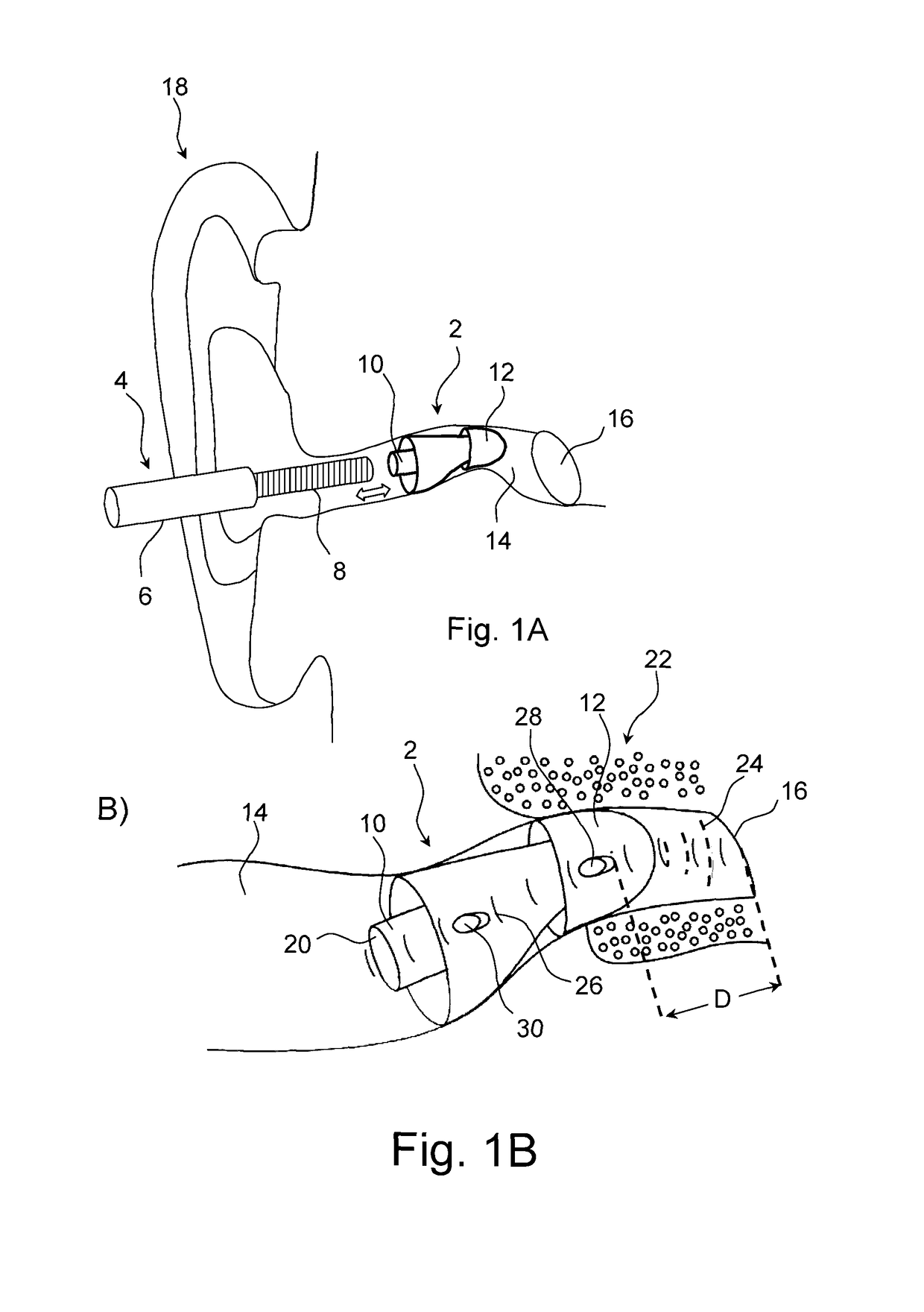 Hearing aid device with positioning guide and hearing aid device system