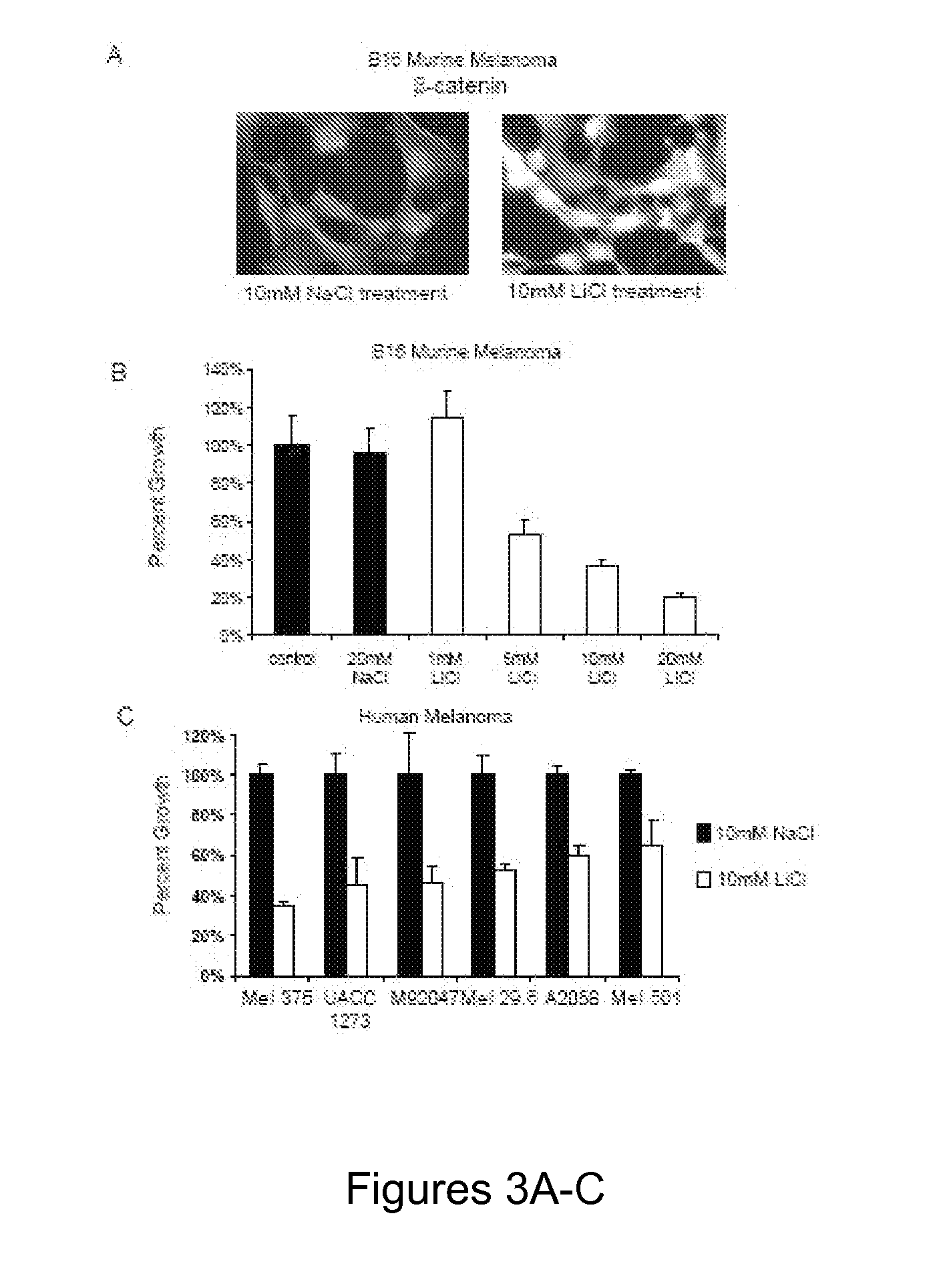 Compositions of modulators of the wnt/b-catenin pathway and an n-cinnamyl-n'benzhydryl piperazine and their use in treating neoplastic conditions including malignant melanoma