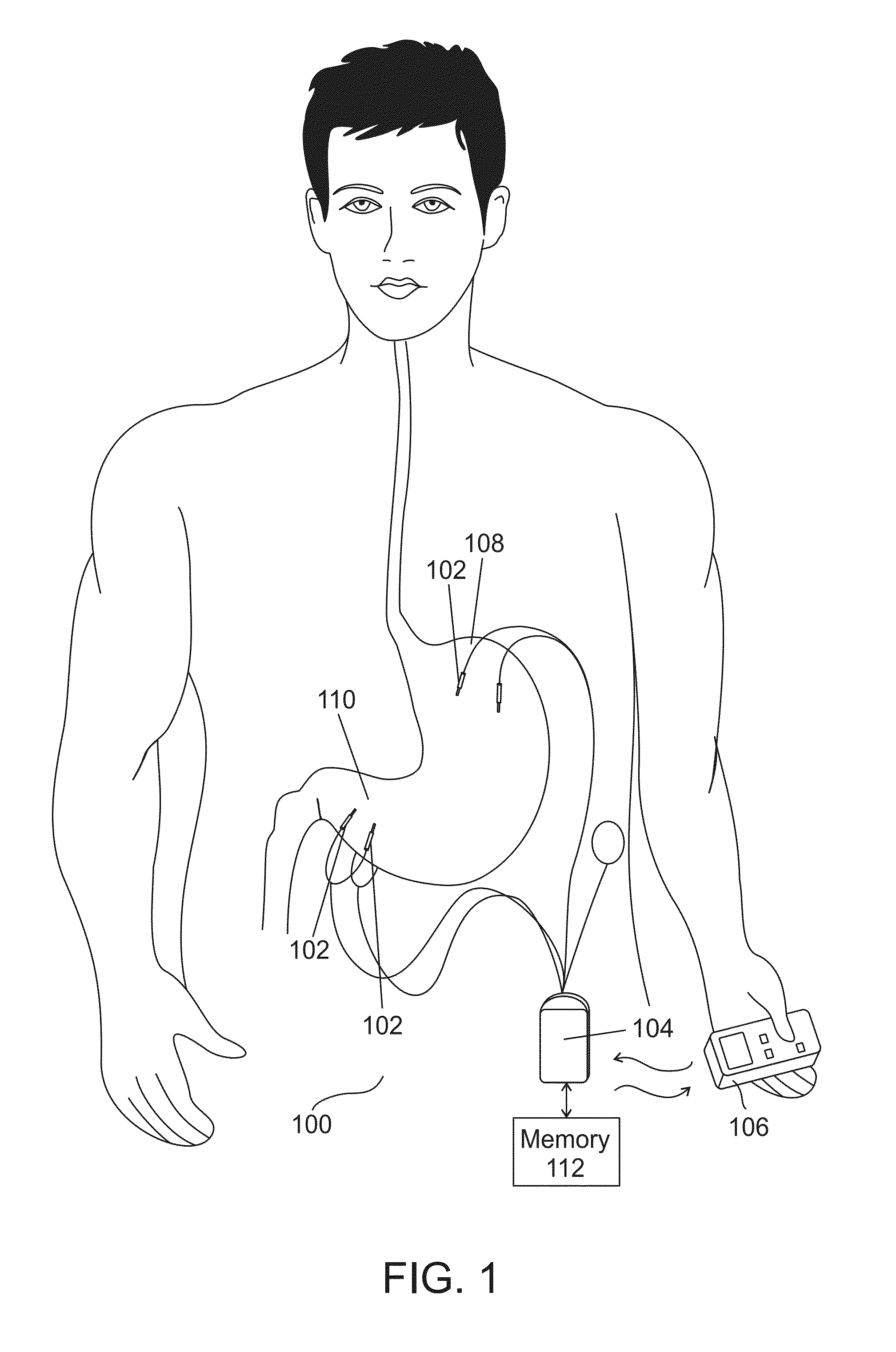 Method of treating a patient