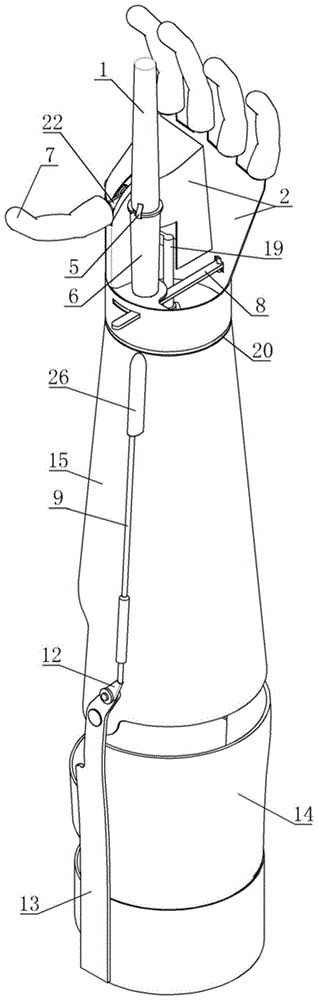 Upper Limb Prosthetics