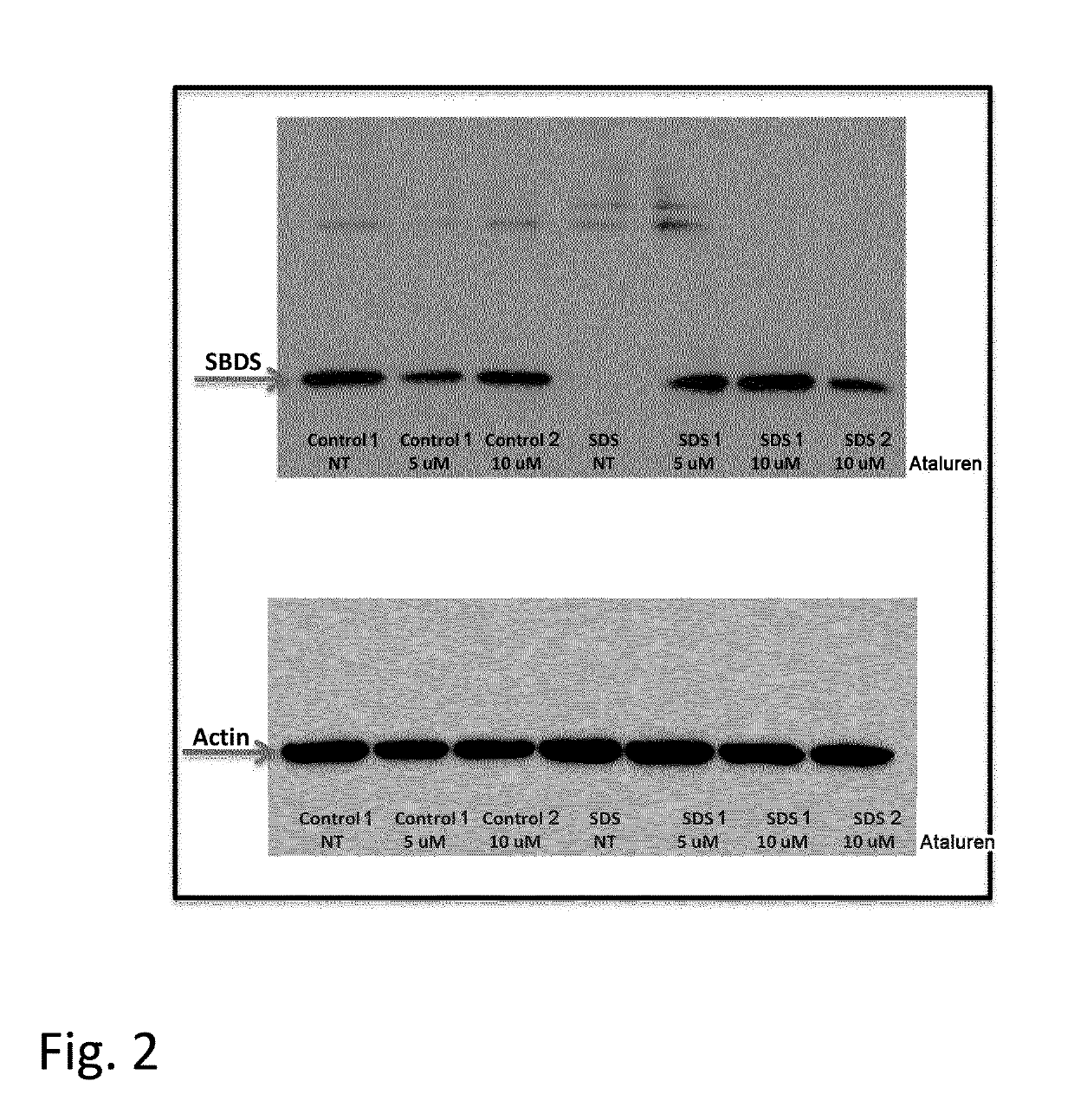 Method of treatment of shwachman-diamond syndrome