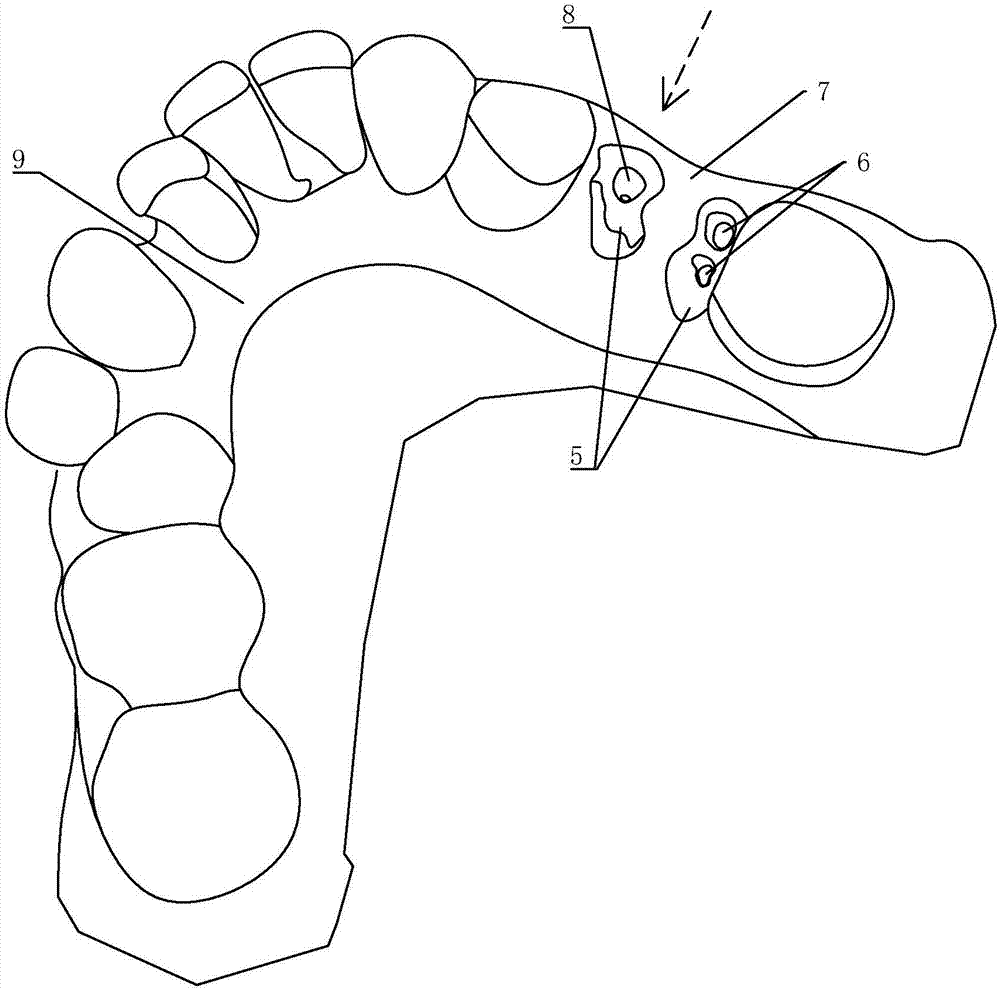 Movable bridge type tooth pile for false tooth