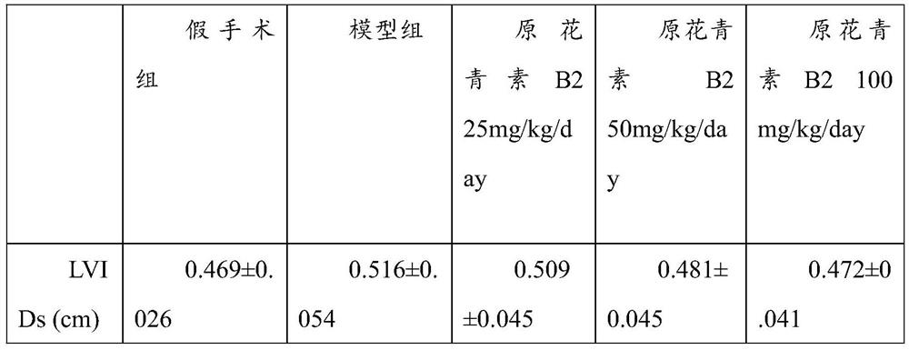 Application of procyanidin B2 in preparation of drug for inhibiting pressure-load ventricular remodeling