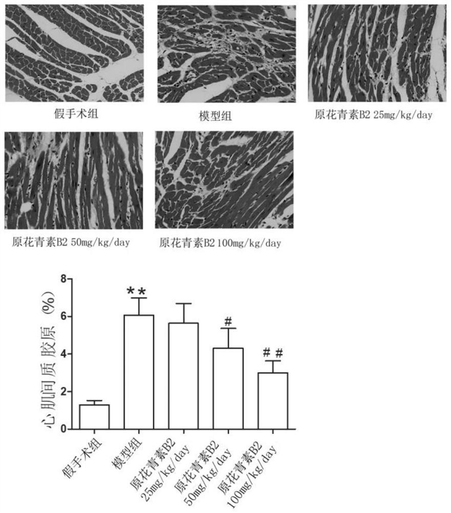 Application of procyanidin B2 in preparation of drug for inhibiting pressure-load ventricular remodeling