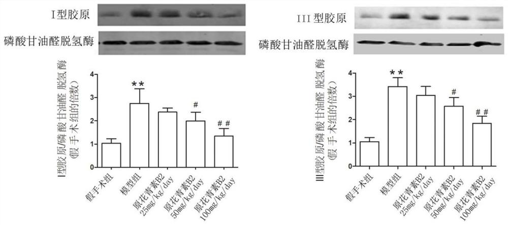 Application of procyanidin B2 in preparation of drug for inhibiting pressure-load ventricular remodeling