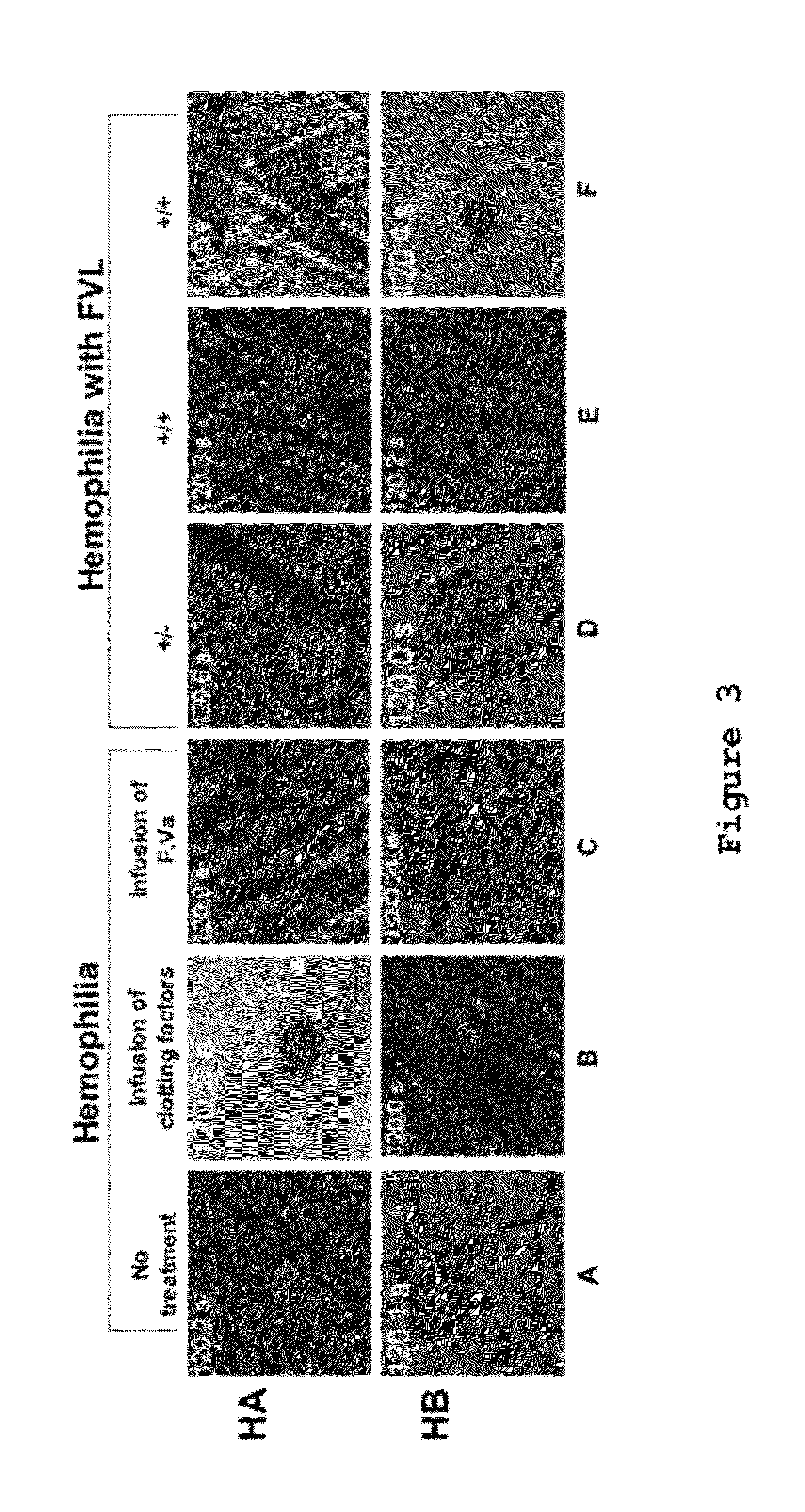 Compositions and Methods for Modulating Hemostasis Using Variant Forms of Activated Factor V