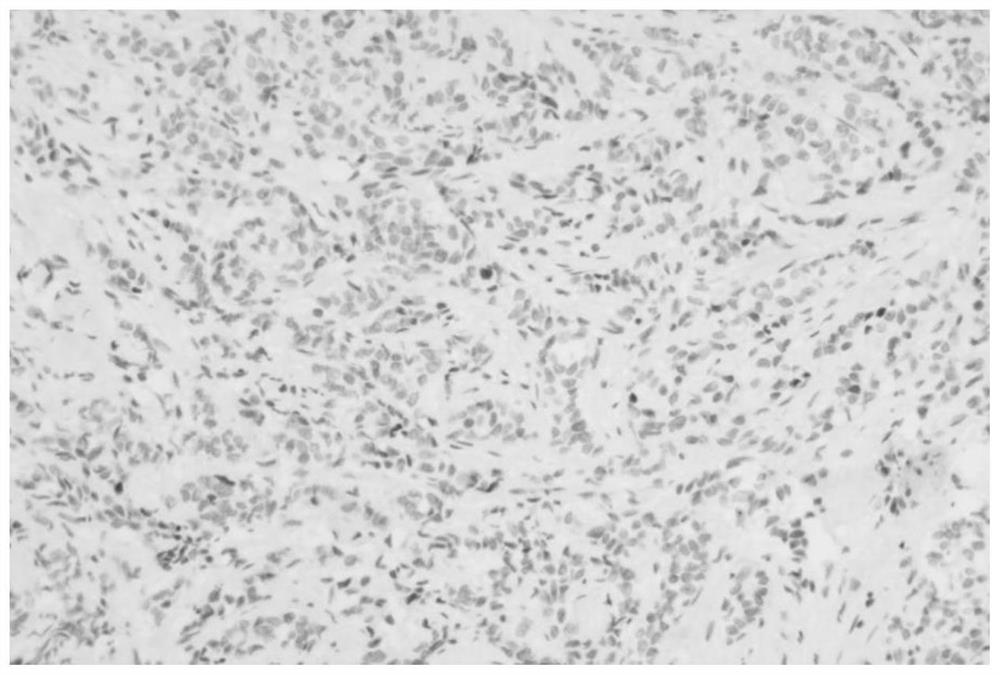 Anti-human nkx3.1 monoclonal antibody and its preparation method and application