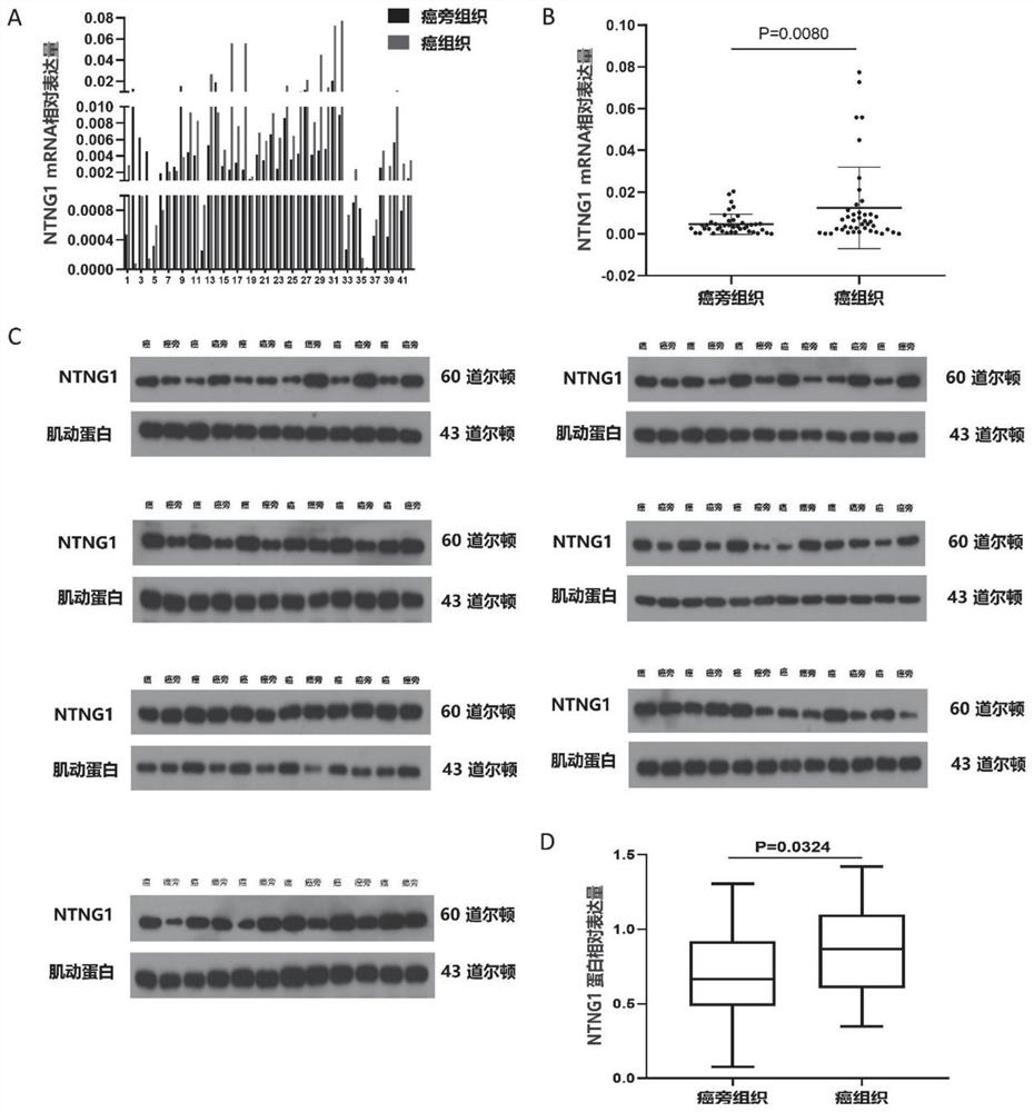 Construction method and application of cell strain for expressing NTNG1 gene