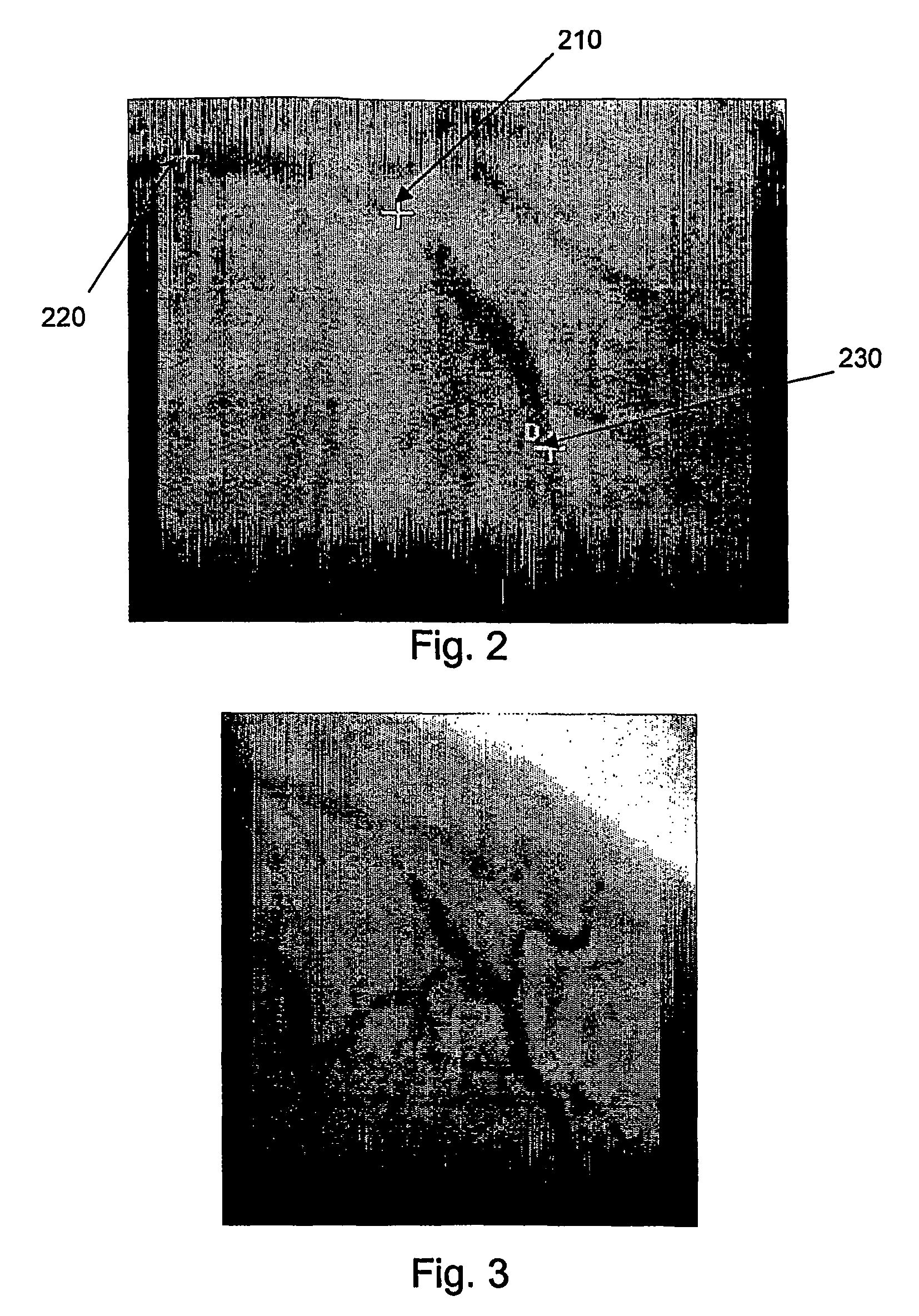 System and method for three-dimensional reconstruction of a tubular organ