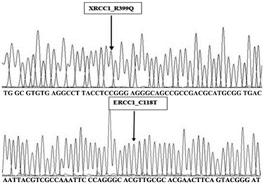 Primer and method for simultaneously detecting XRCC1, ERCC1 and GSTP1 gene polymorphisms