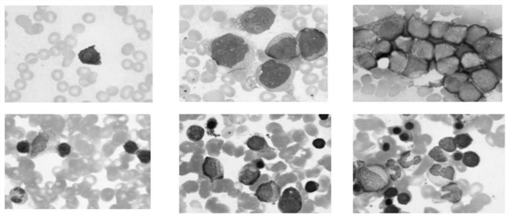 Bone marrow smear microscopic image analysis method and device, electronic equipment and storage medium