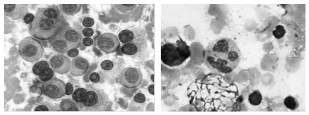 Bone marrow smear microscopic image analysis method and device, electronic equipment and storage medium