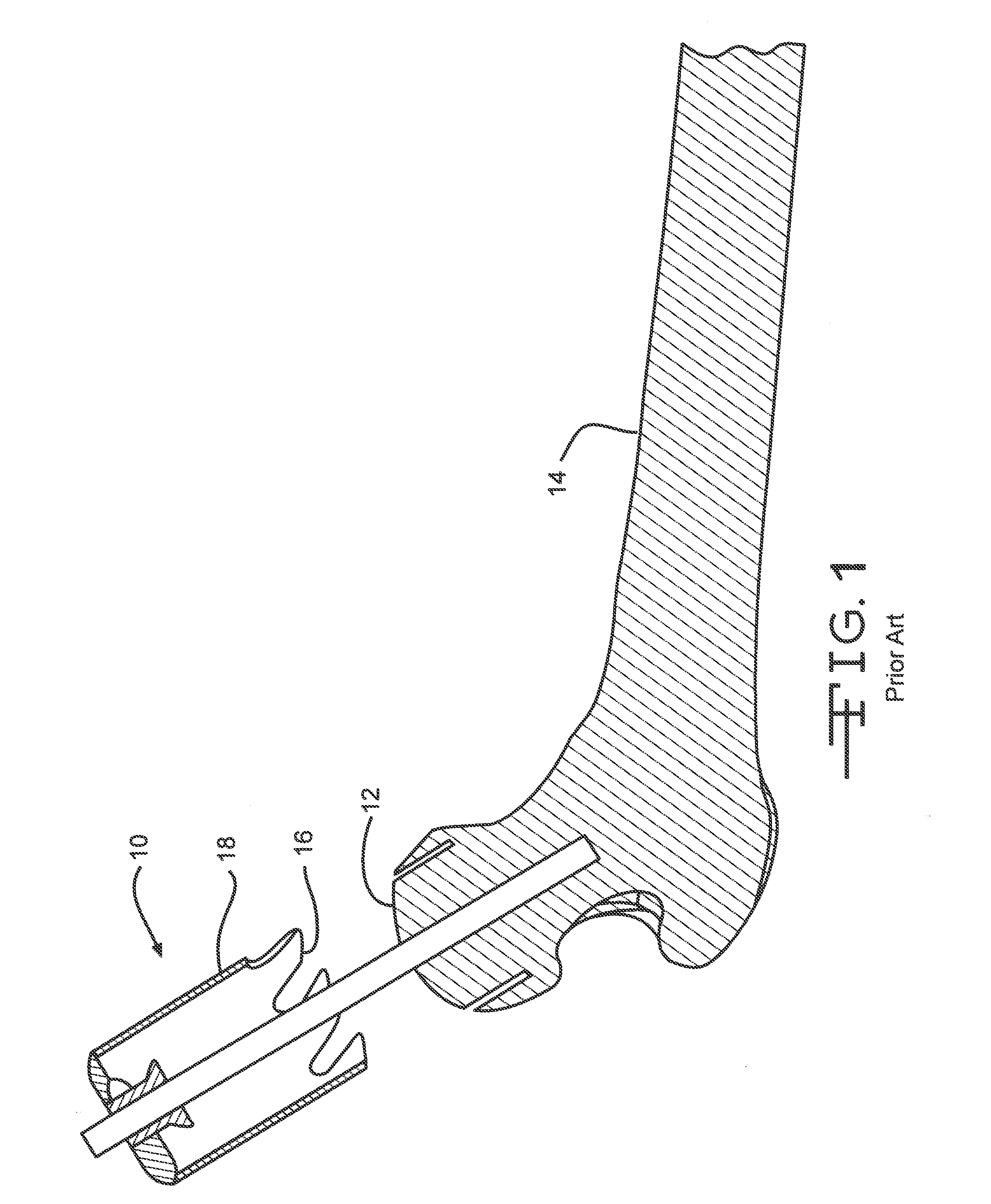 Disposable Surgical Cutter For Shaping The Head Of A Femur