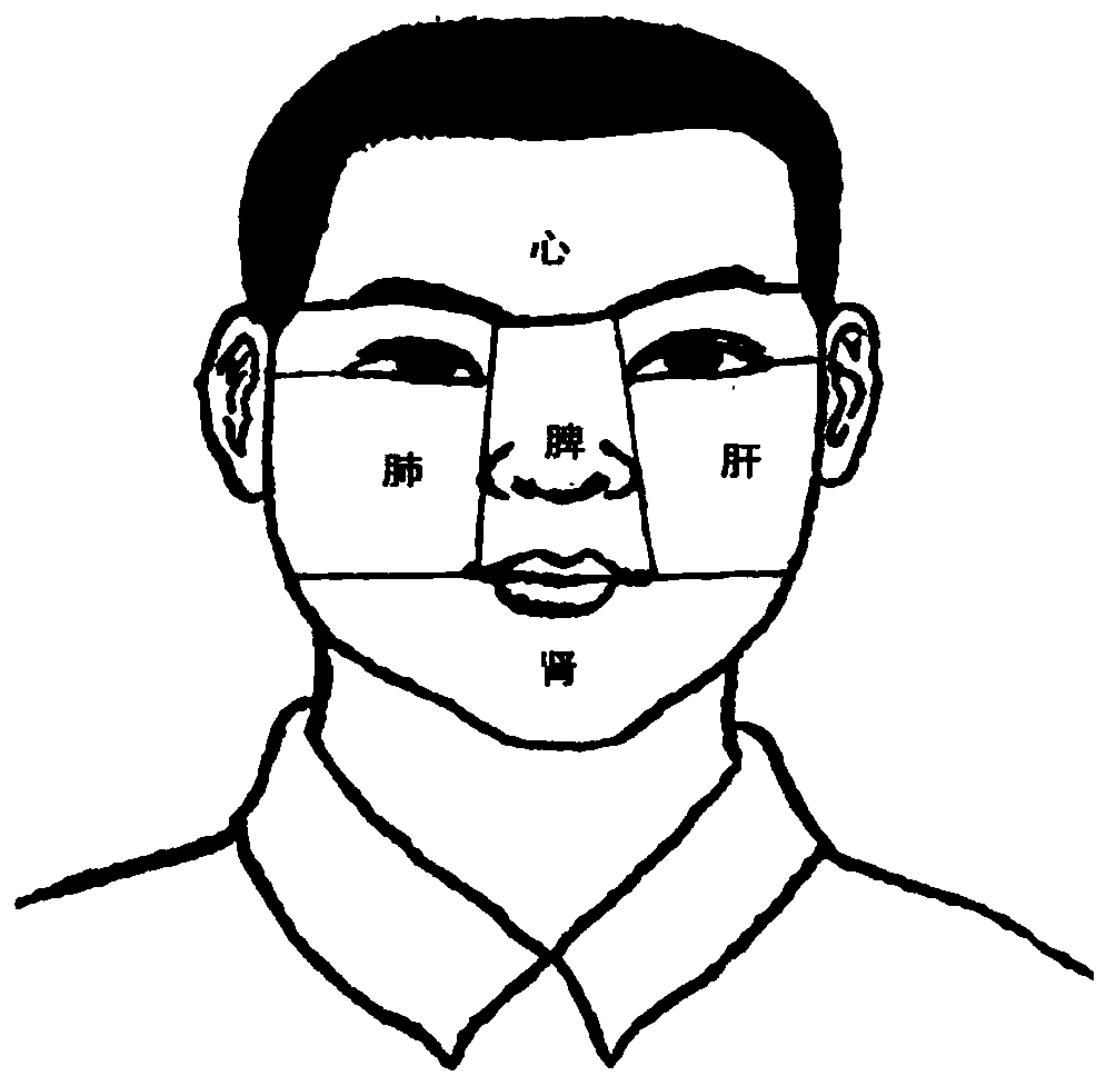 An automatic classification method of complexion in traditional Chinese medicine using shallow neural network