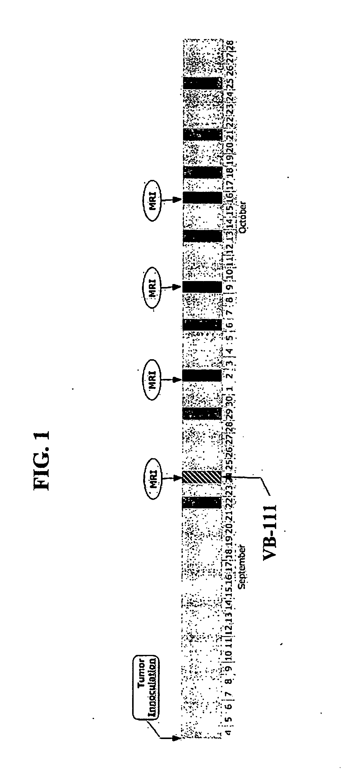 Compositions and Methods for Treating Glioblastoma GBM