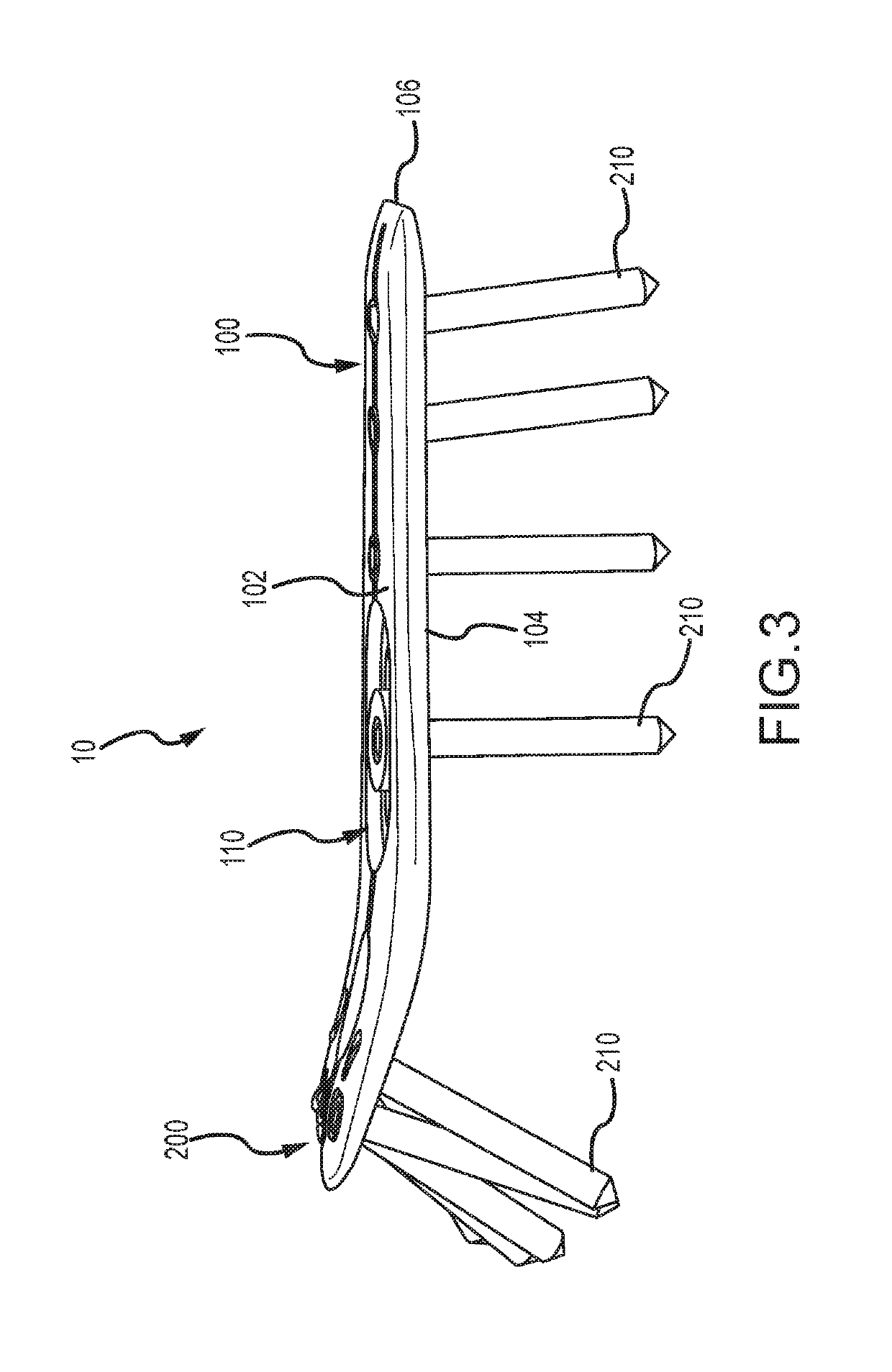 Distal radius plate