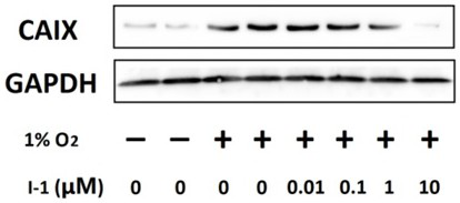 Acetazolamide derivative and its preparation method and application in preparation of medicine for treating coronary heart disease