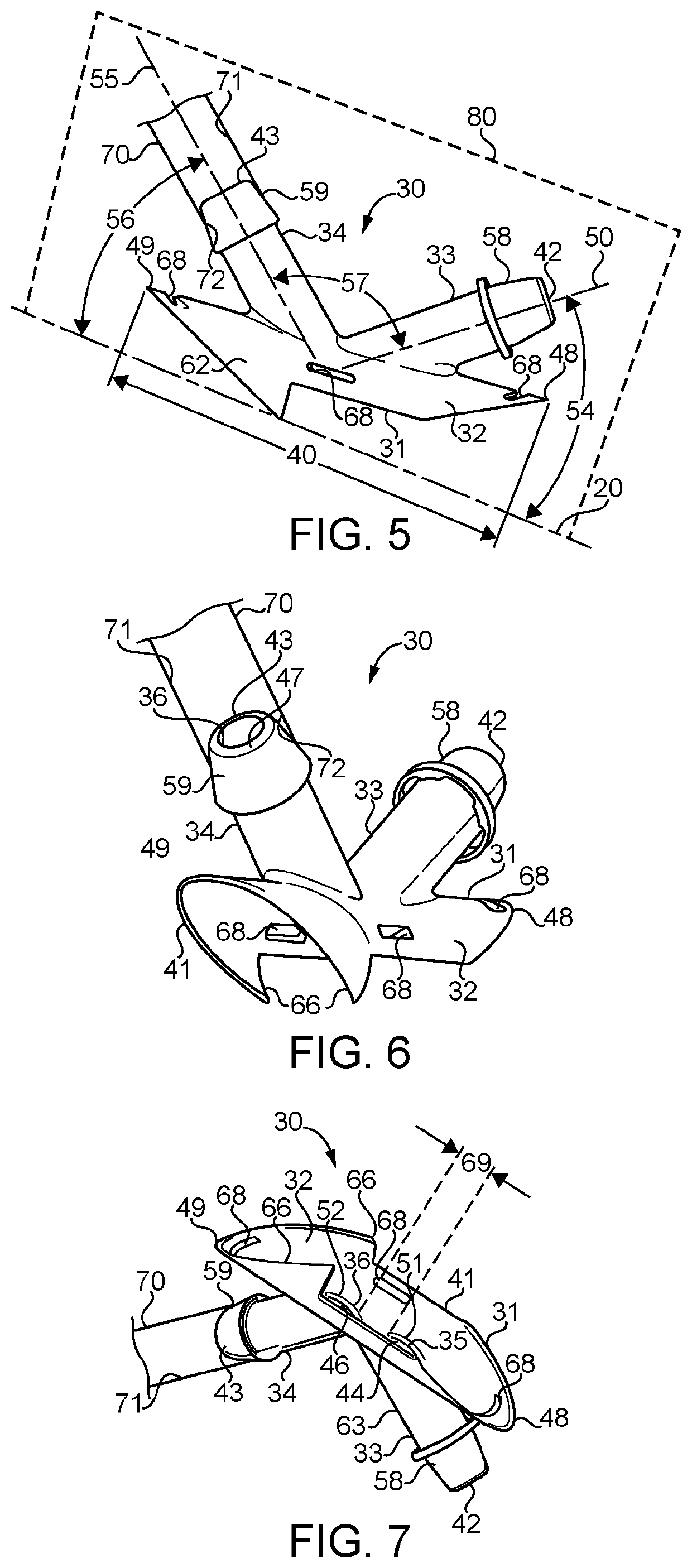 Combined arterial venous fistula graft implant and method of using same