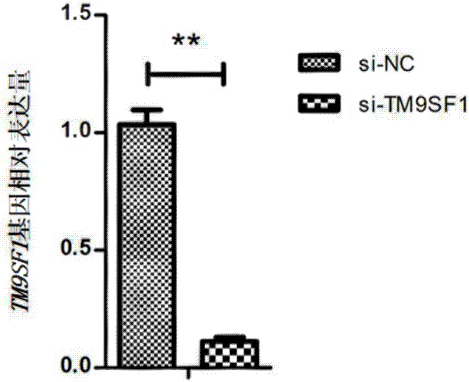 Application of TM9SF1 gene as target point to vascular disease