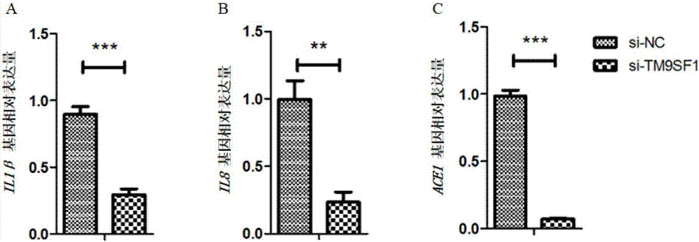 Application of TM9SF1 gene as target point to vascular disease