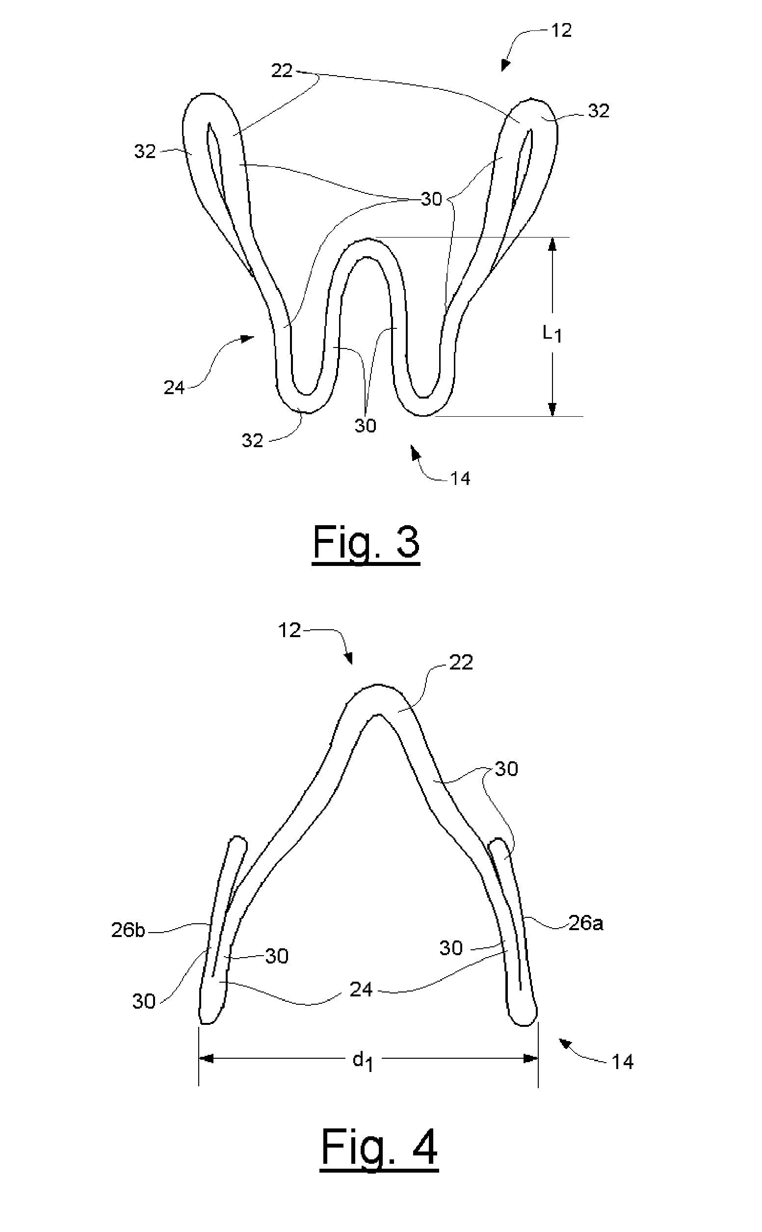 Intravaginal incontinence device