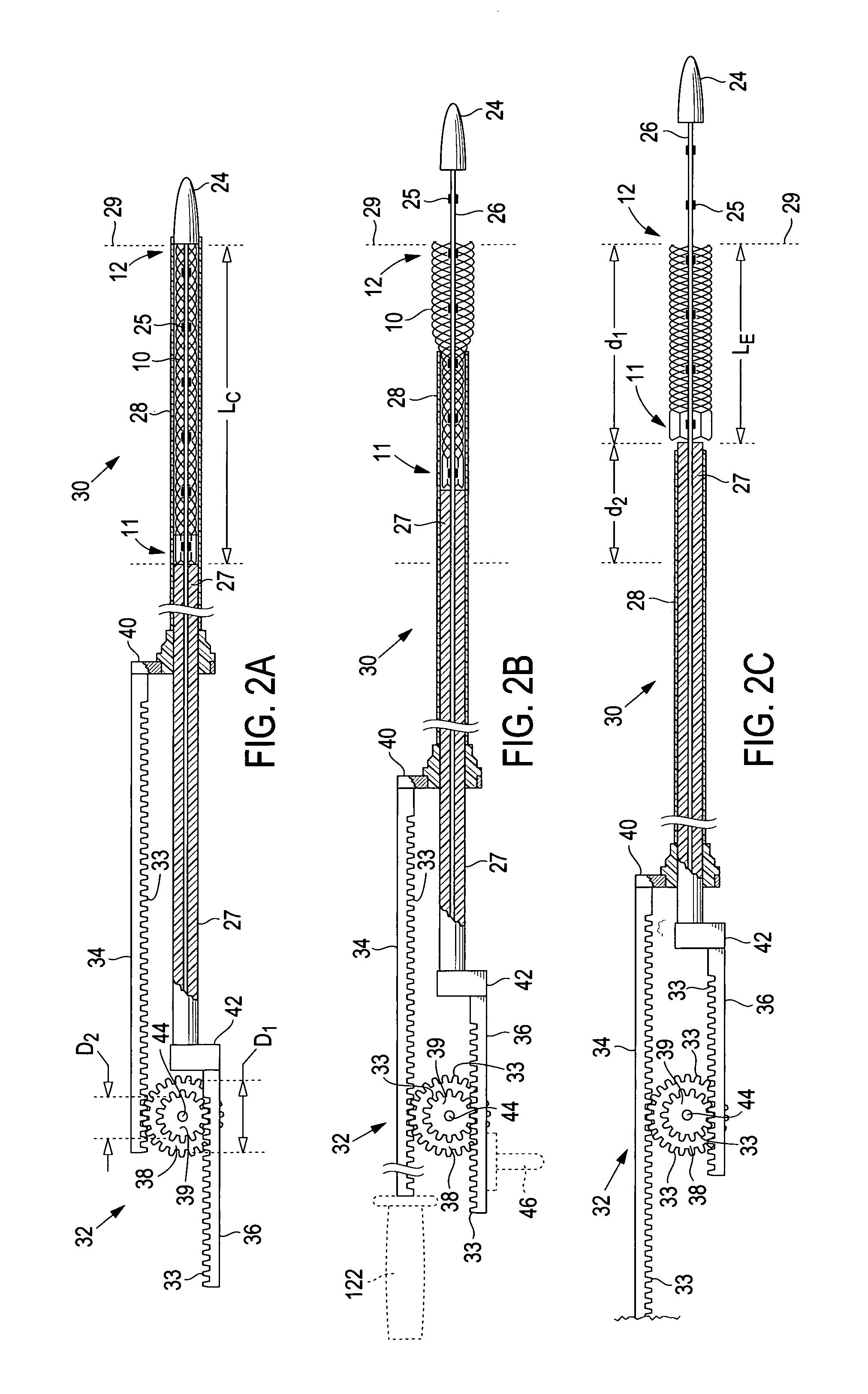 Delivery system and method for deployment of foreshortening endoluminal devices
