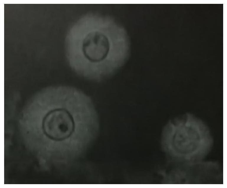 A kind of cryptococcal capsule staining solution and its preparation and use method