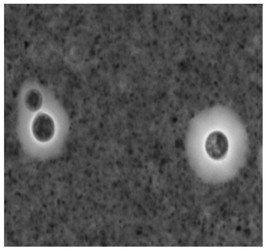 A kind of cryptococcal capsule staining solution and its preparation and use method