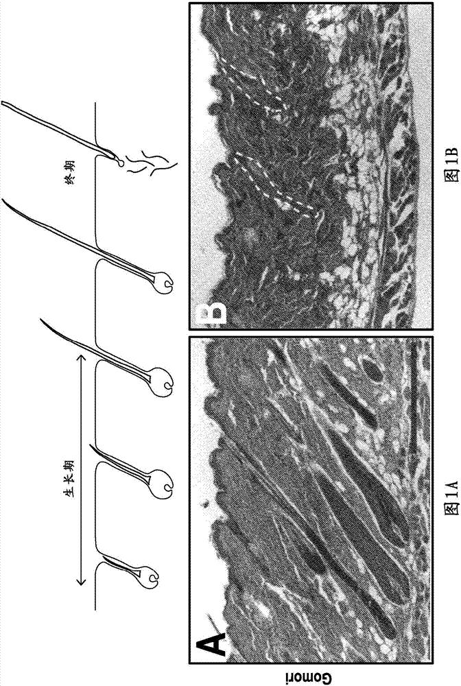 R-spondin agonist-mediated hair growth