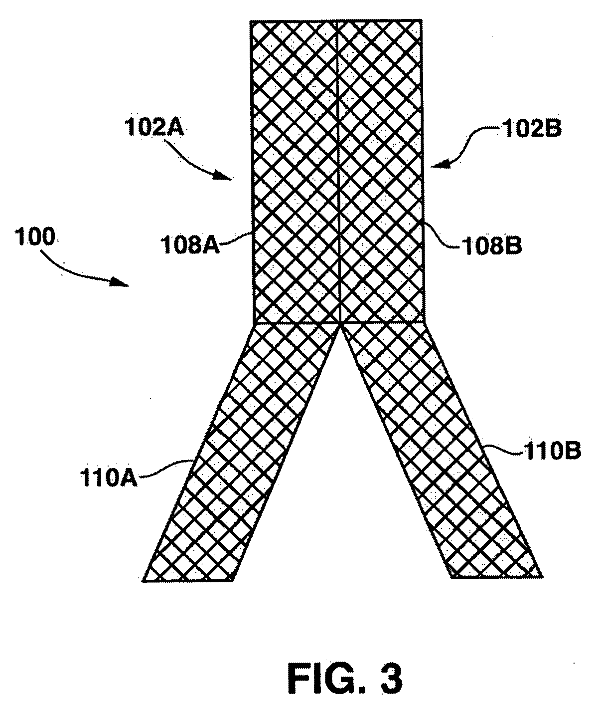 Stent having a C-shaped body section for use in a bifurcation