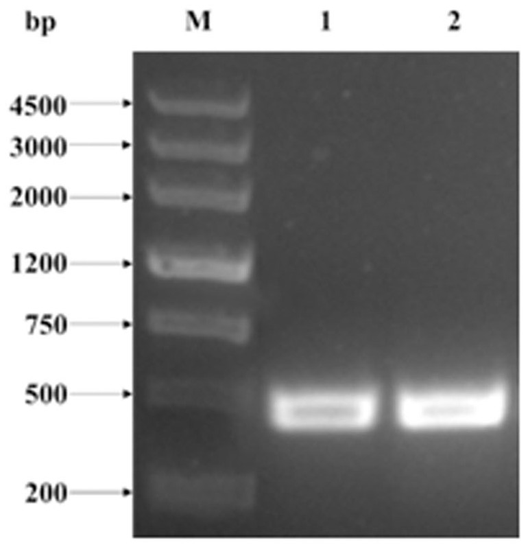 Application of Verticillium dahliae VdPRMT1 gene in improvement of disease resistance of crops or vegetables