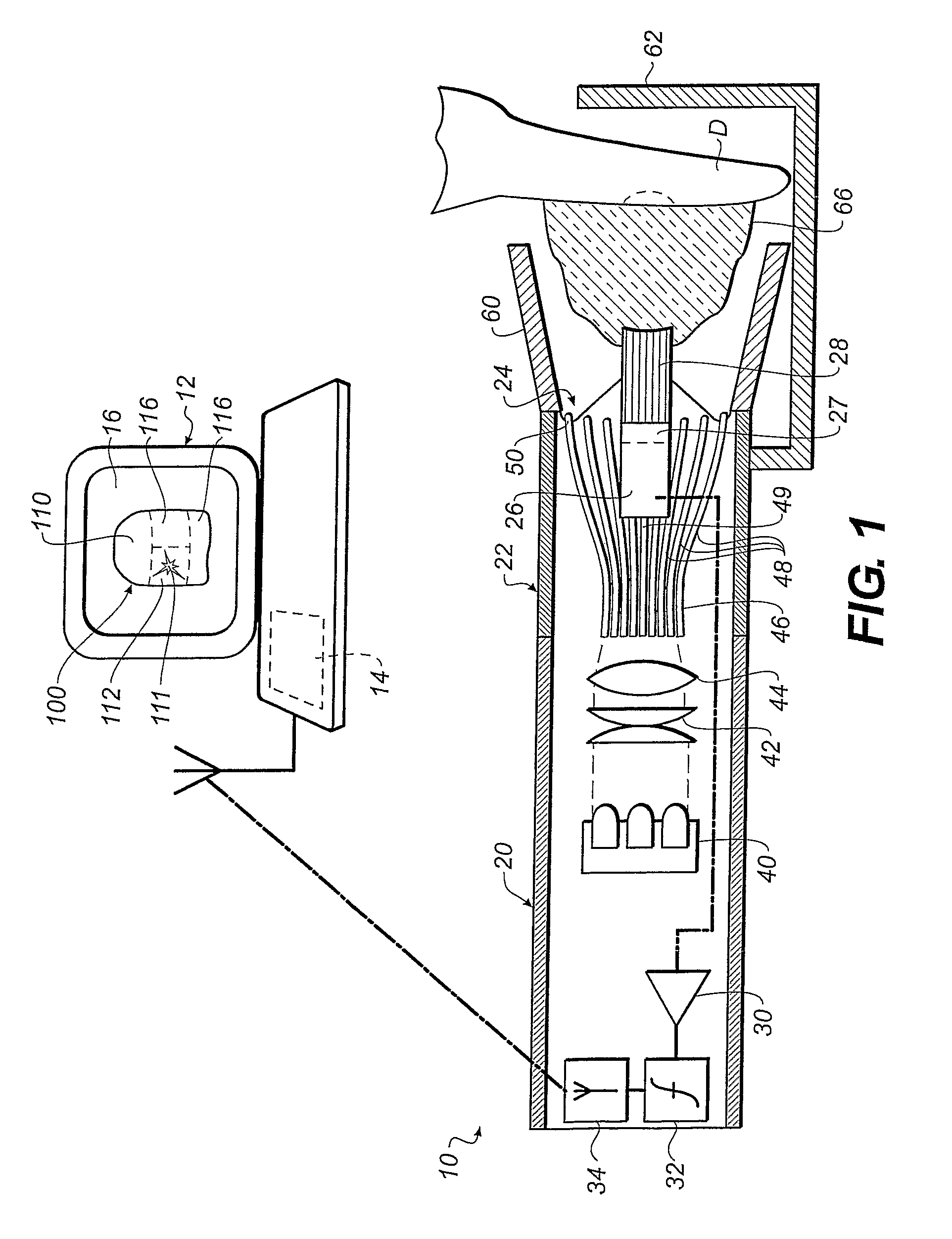 Equipment and method for measuring dental shade