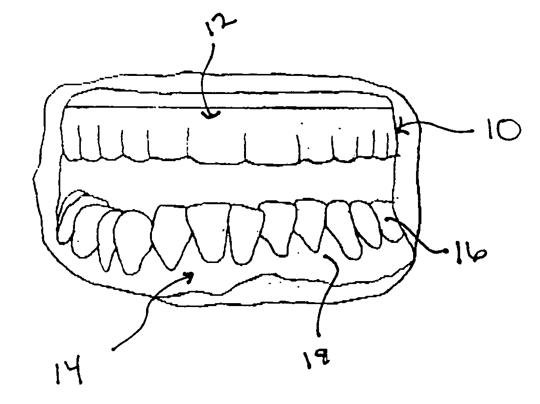 Mouthguard and method of making the mouthguard