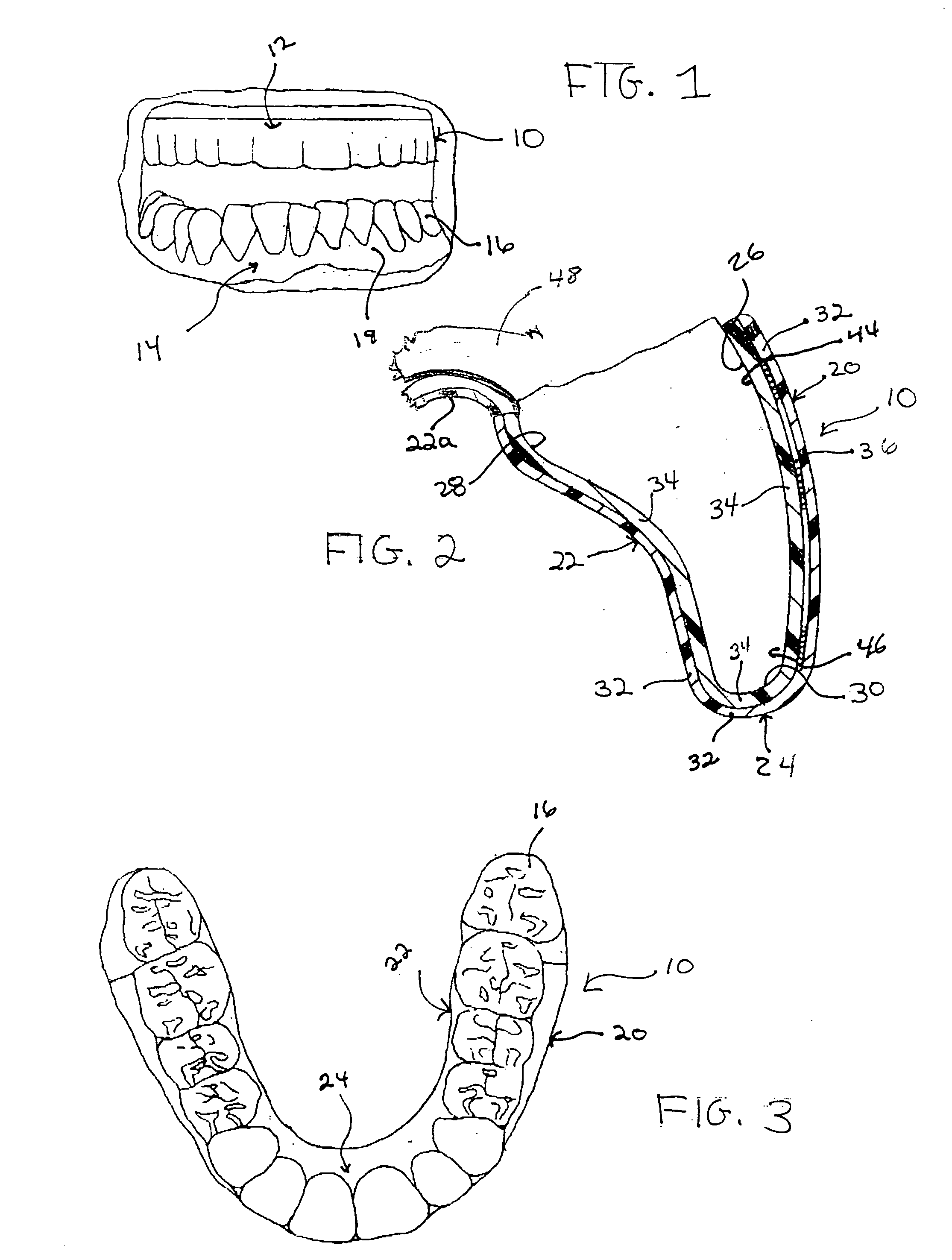 Mouthguard and method of making the mouthguard