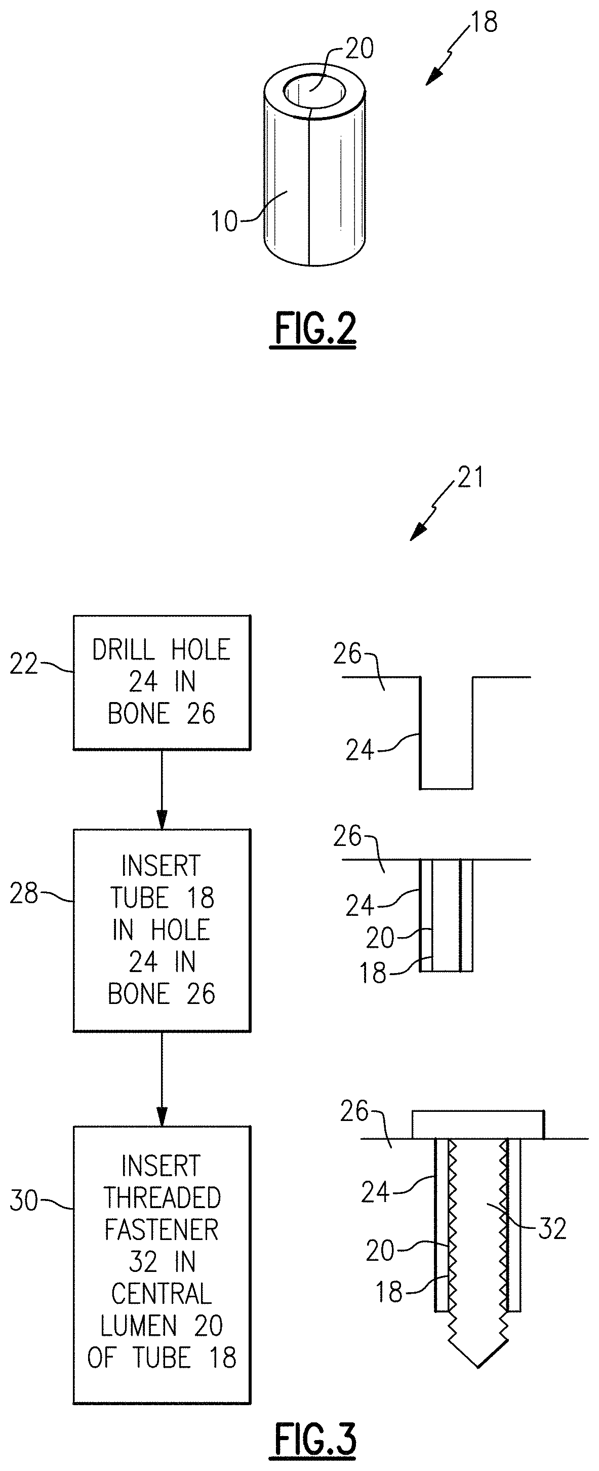 Three dimensional spacer fabric to increase the holding power of screws