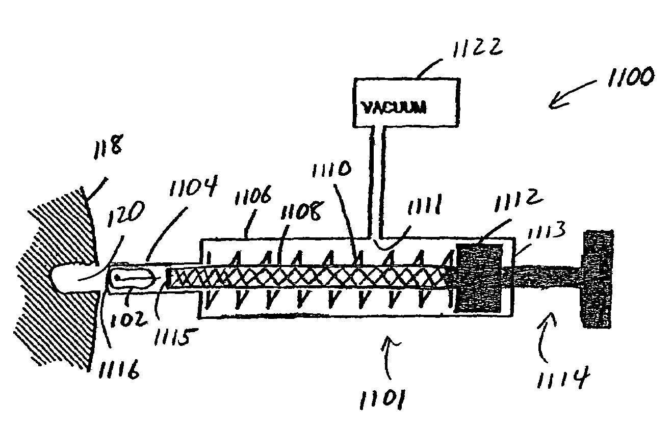 Method and apparatus for transplanting a hair graft