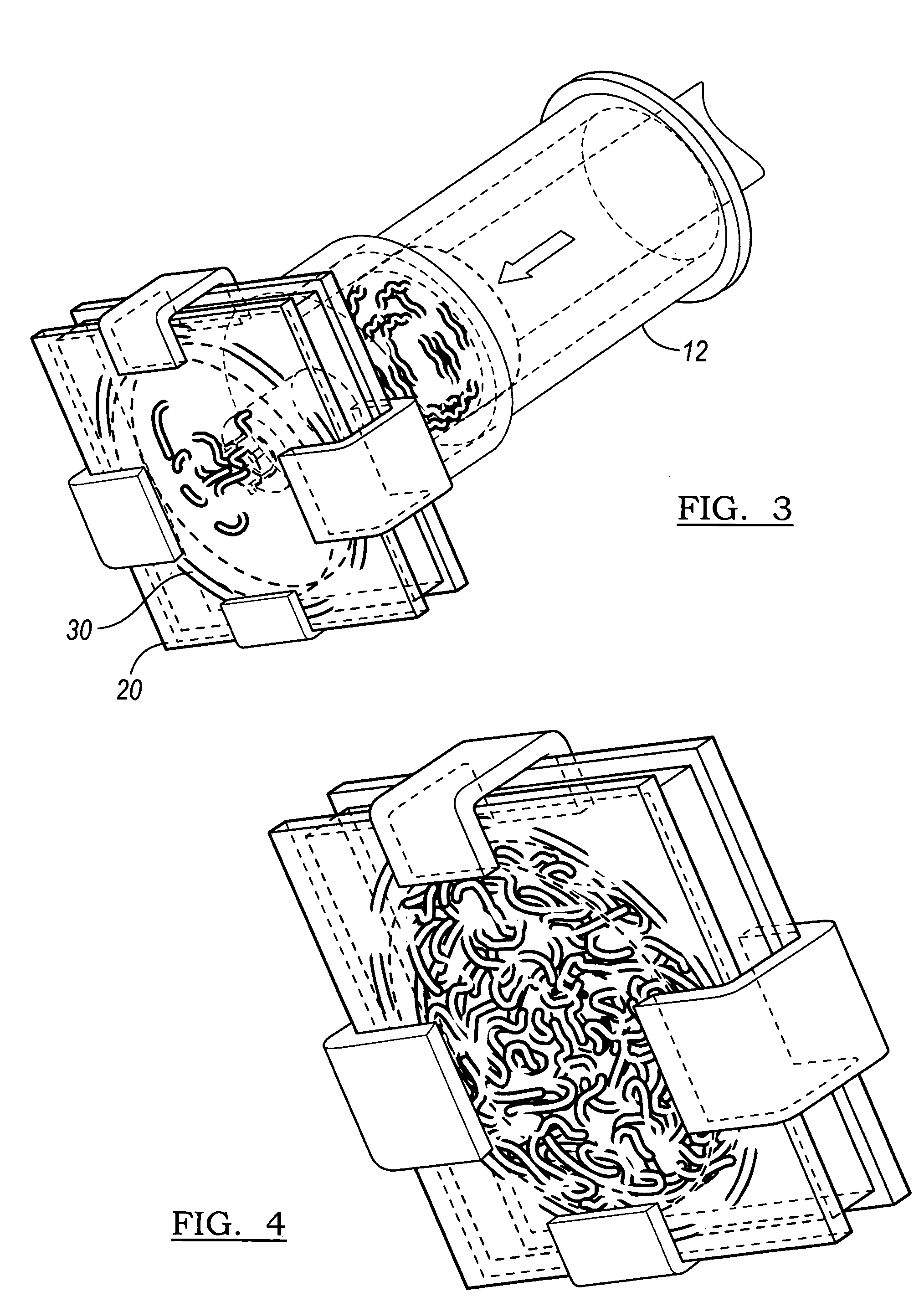 Method and apparatus for preparing bone