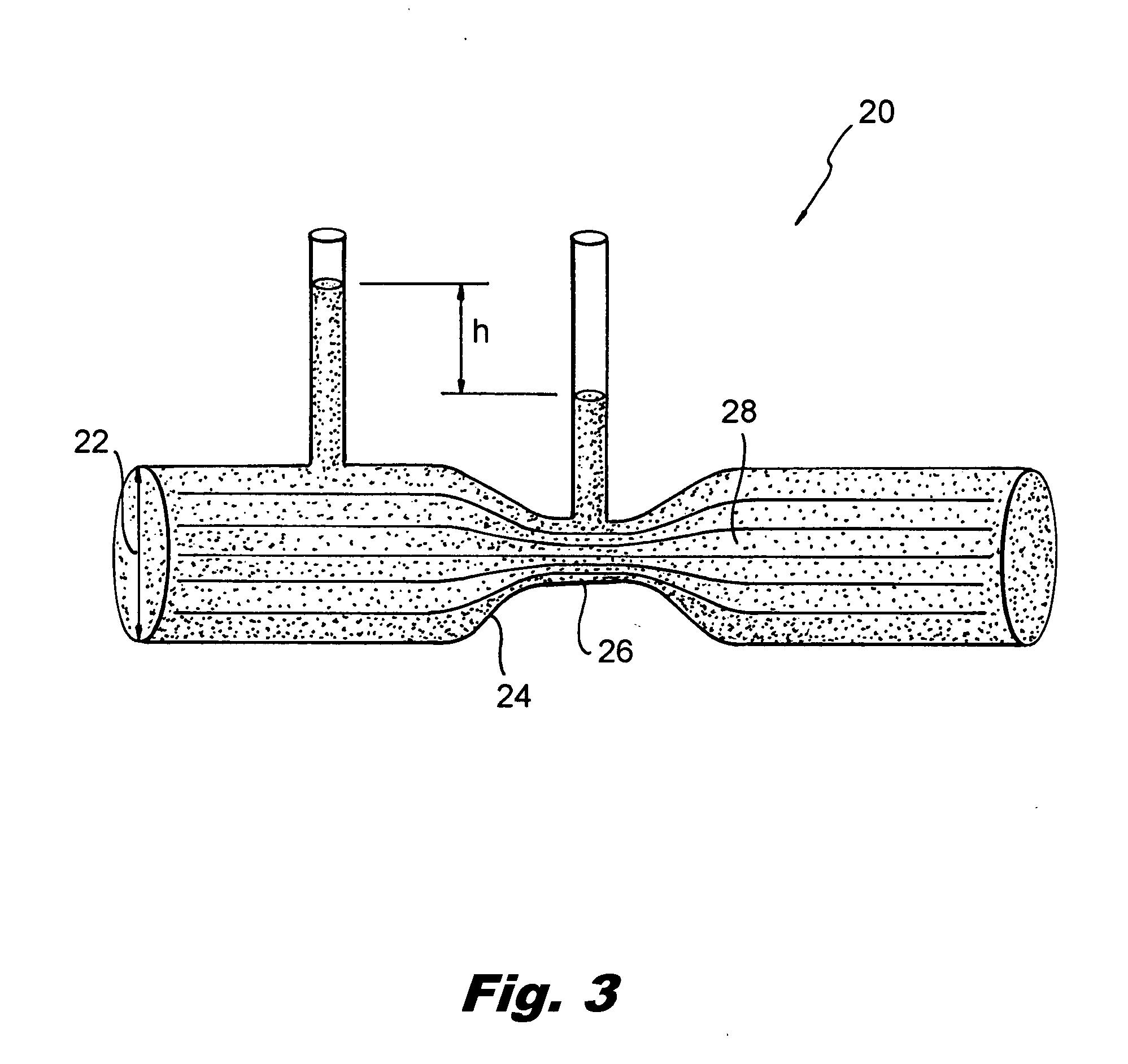 System and method for creating a venturi effect within an orifice