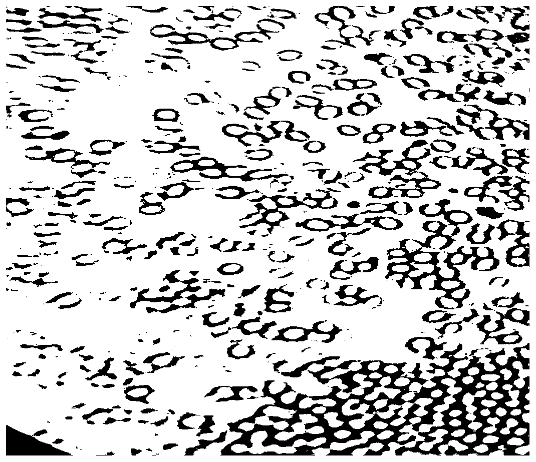 Acid-proof yeast and applications thereof