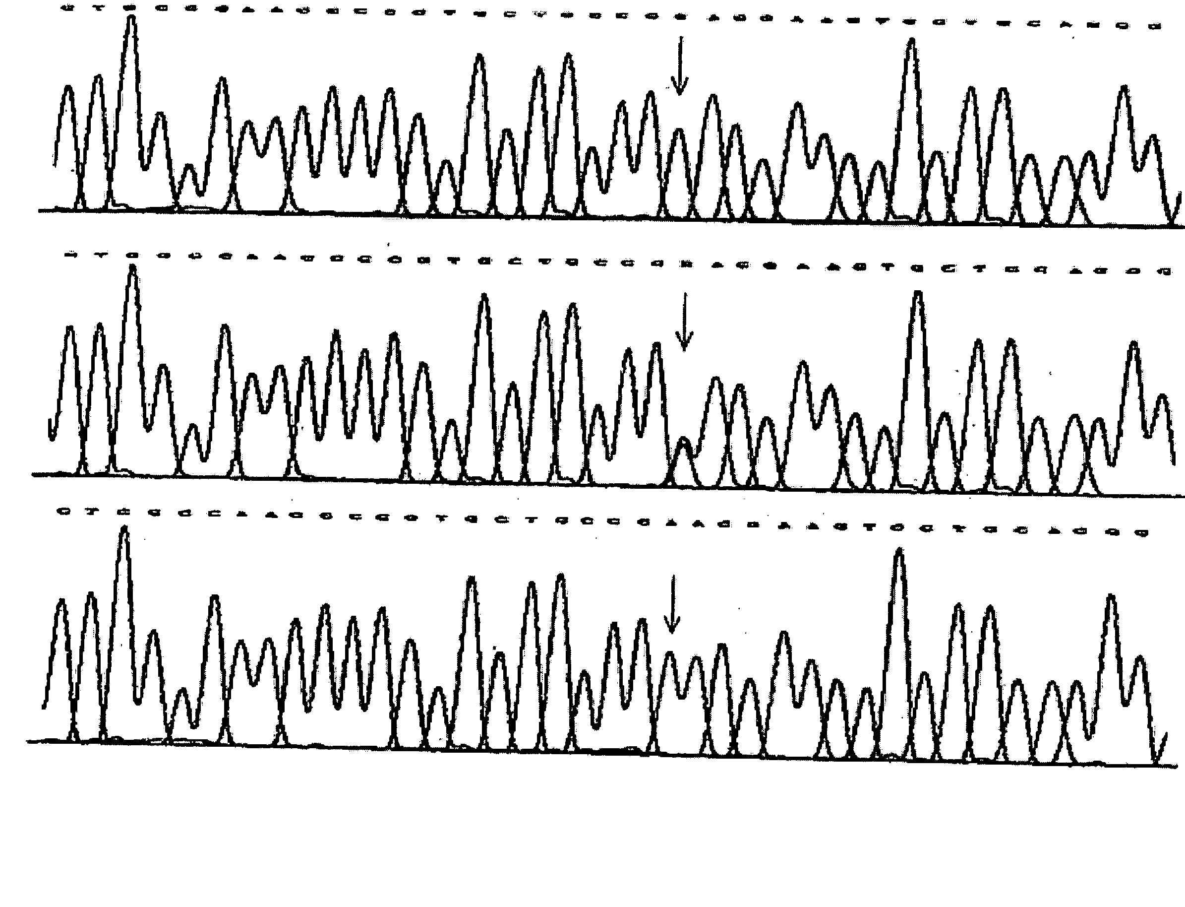 Assay device of XPD/ERCC2 gene polymorphisms for the correct administration of chemotherapy in lung cancer