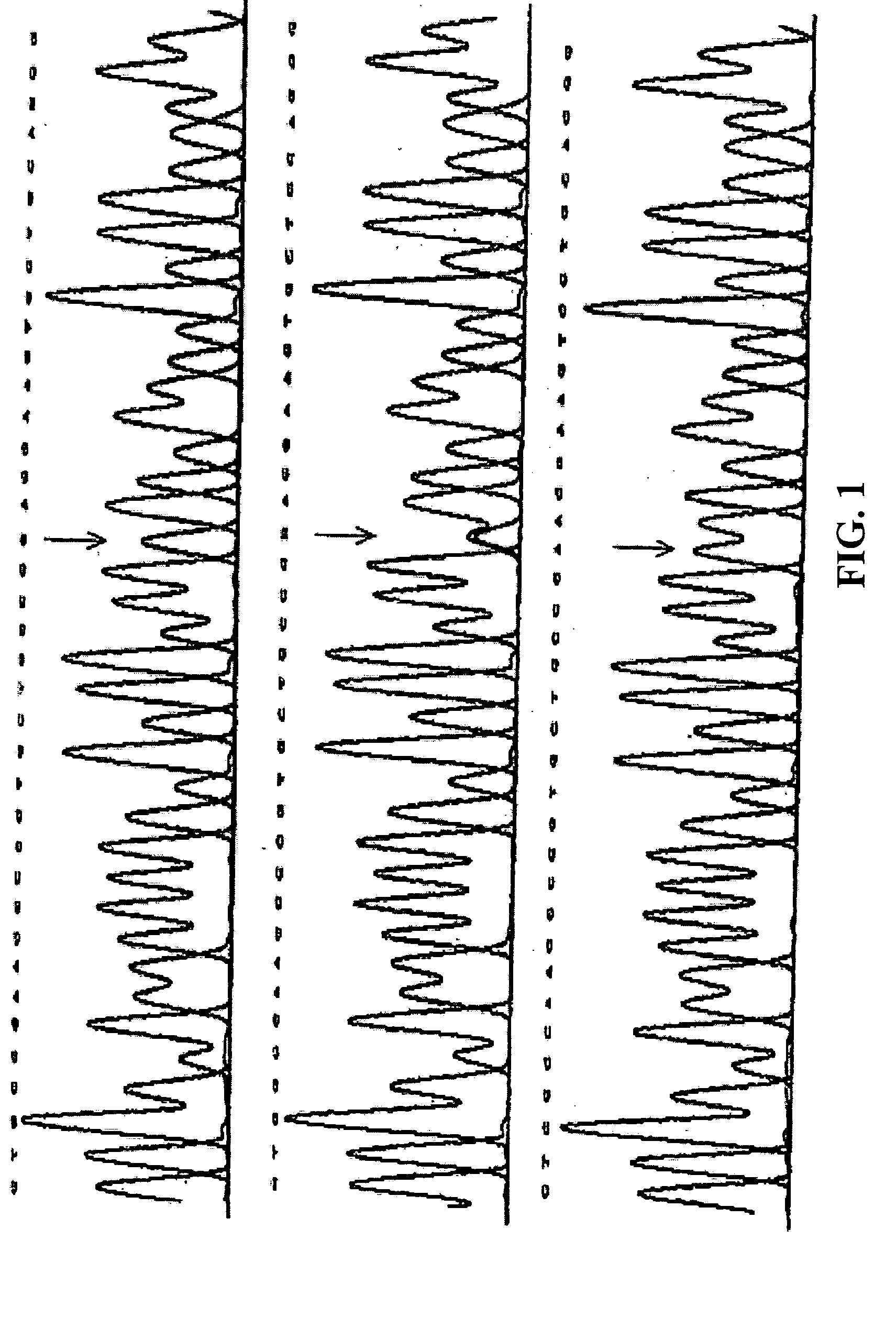 Assay device of XPD/ERCC2 gene polymorphisms for the correct administration of chemotherapy in lung cancer