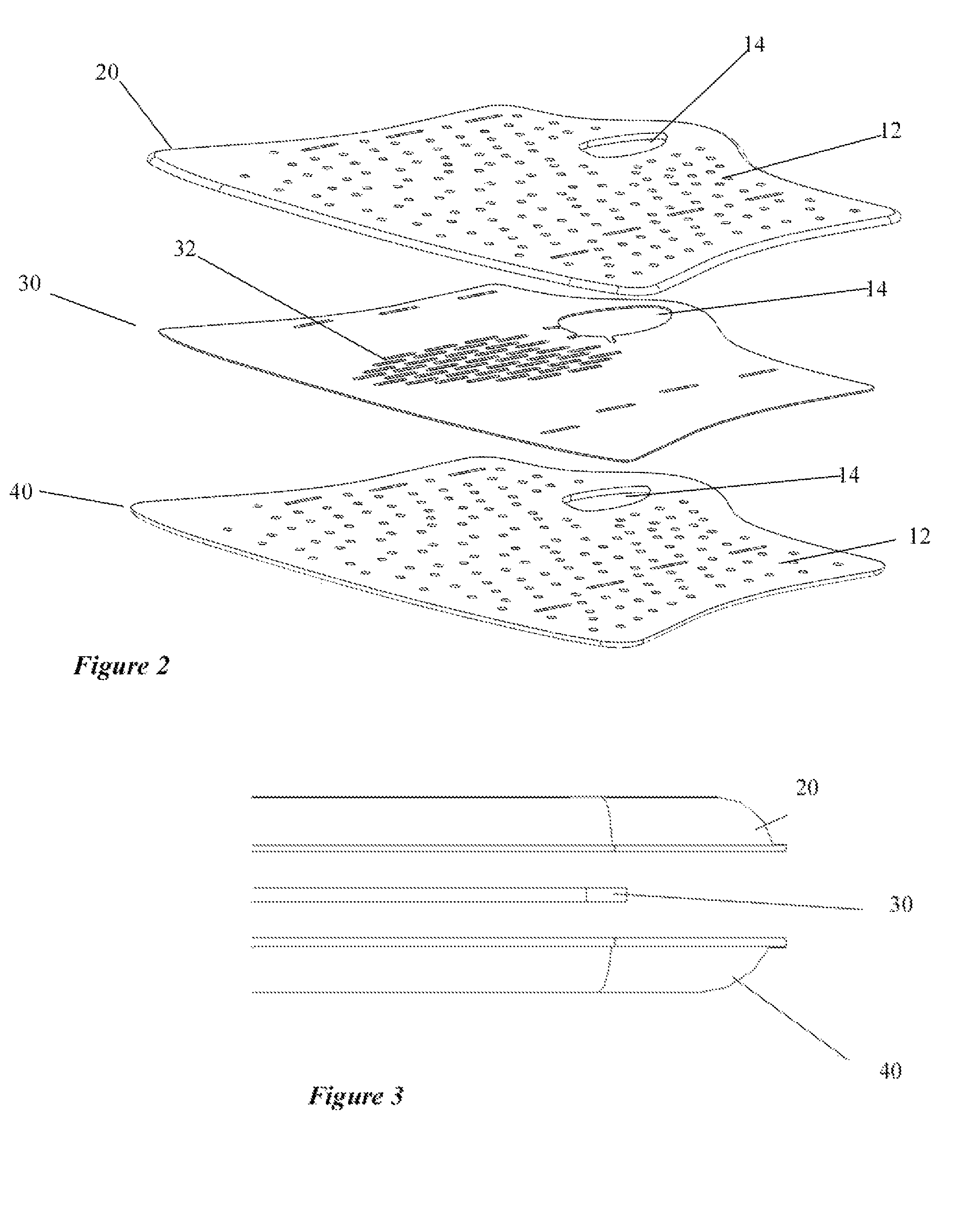 Orthopedic system for immobilizing and supporting body parts