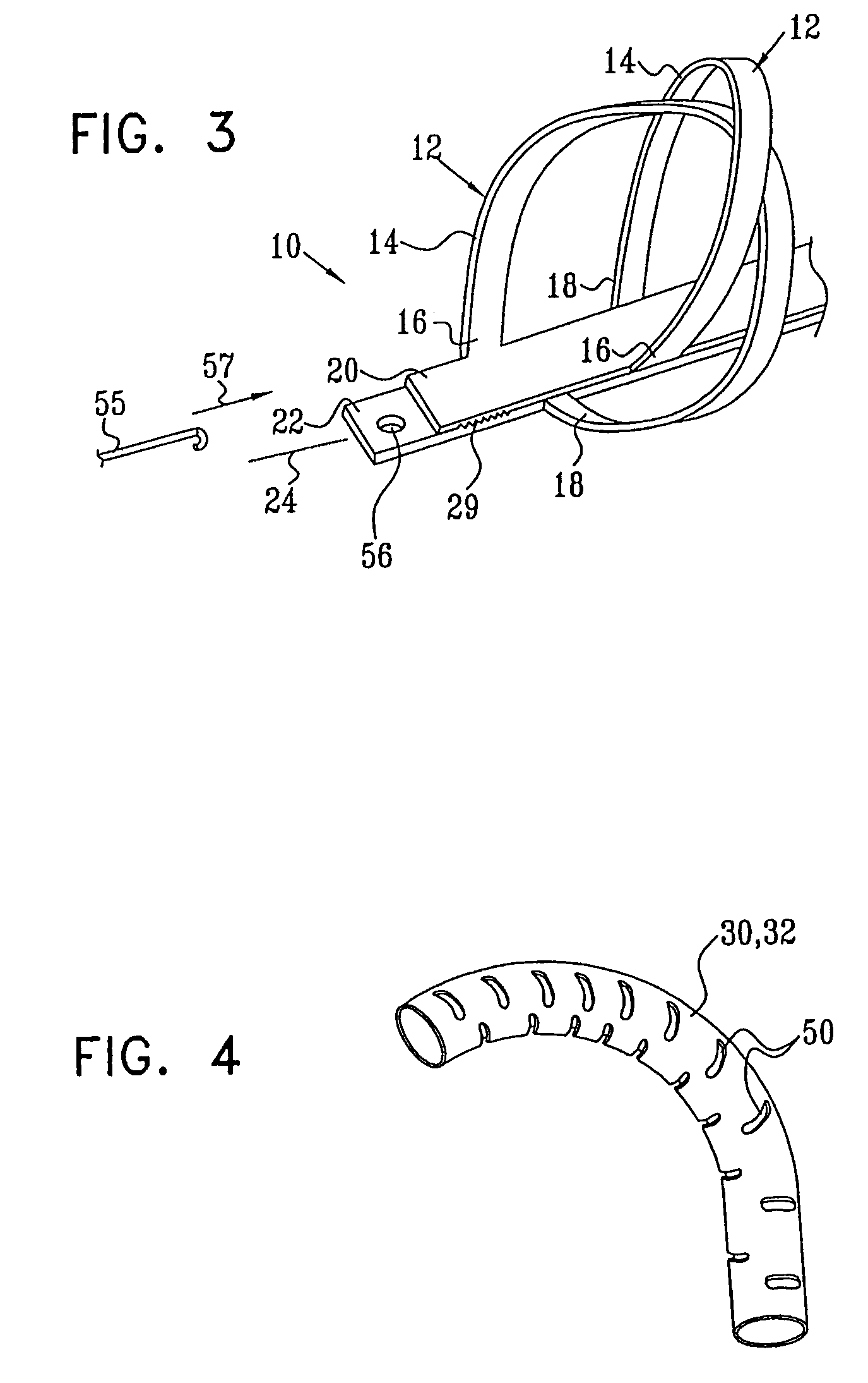 Selectively expandable and releasable stent
